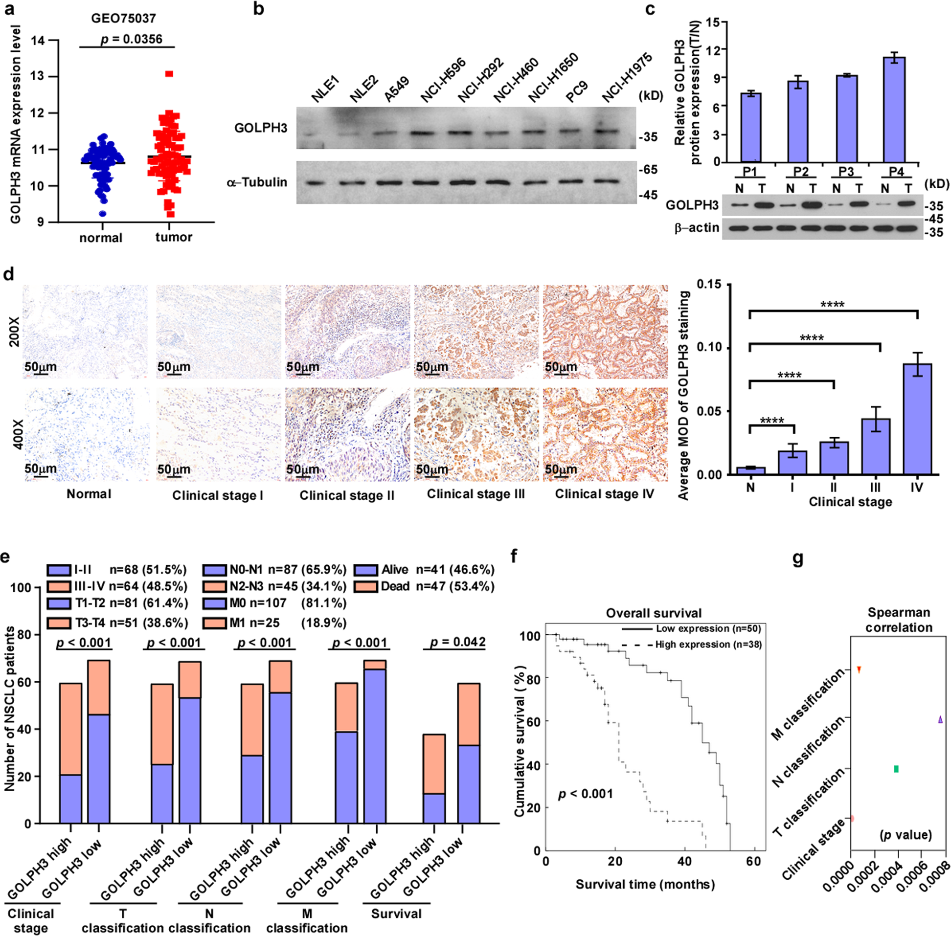 GOLPH3/CKAP4 promotes metastasis and tumorigenicity by enhancing the  secretion of exosomal WNT3A in non-small-cell lung cancer | Cell Death &  Disease