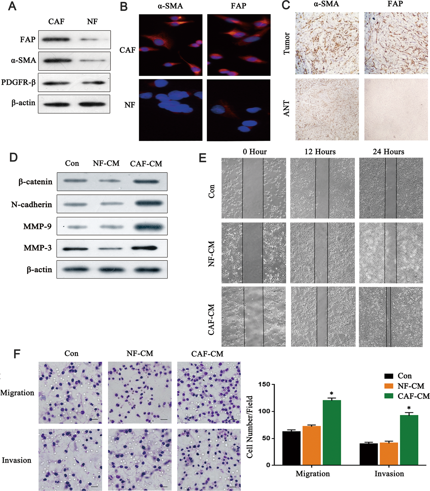 Epigenetic silencing of TCEAL7 (Bex4) in ovarian cancer