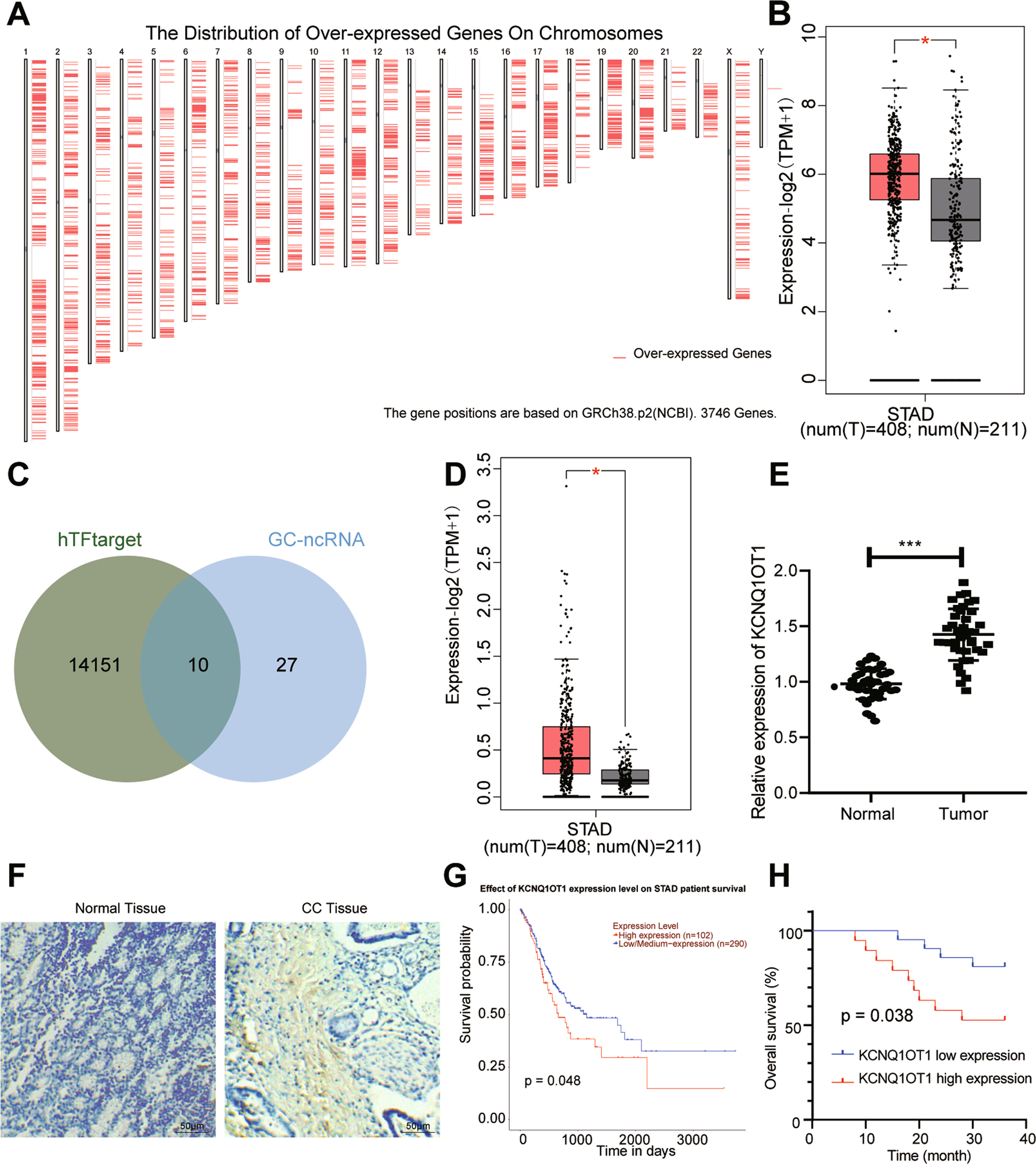 Fig. 1: c-Myc and KCNQ1OT1 expression is high in GC tissues.