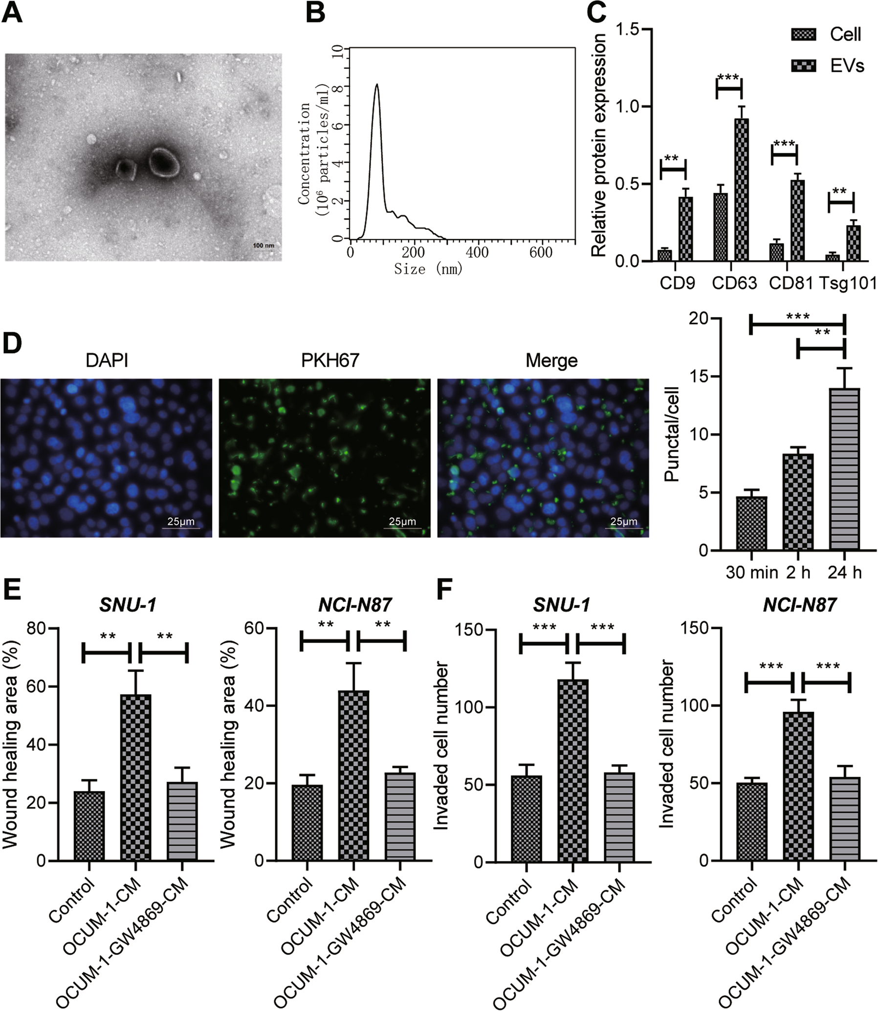 Fig. 2: Tumor-derived EVs induce invasion and migration of GC cells.