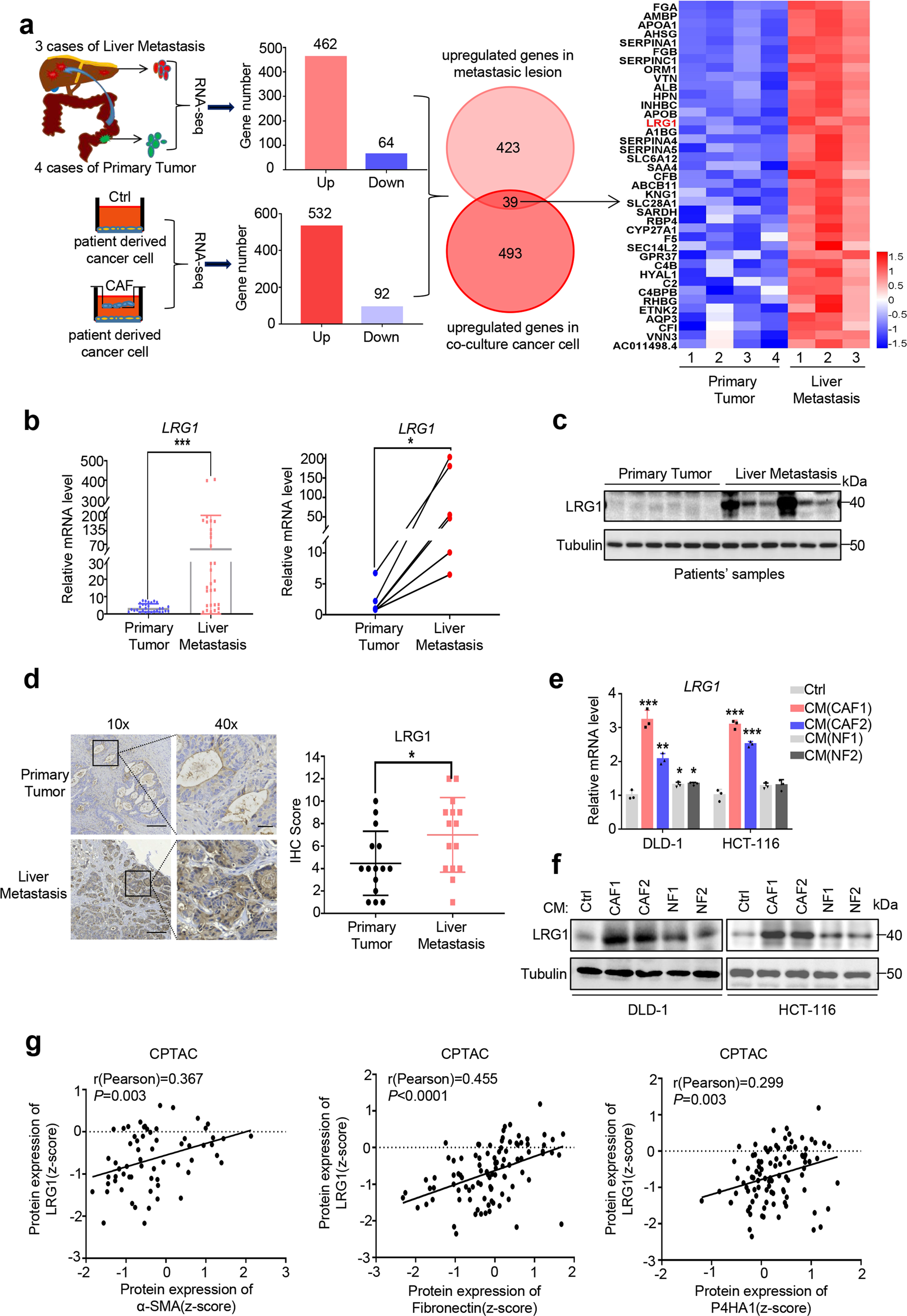 Fig. 1: LRG1 is up-regulated in metastatic colorectal cancer which is associated with cancer-associated fibroblasts.
