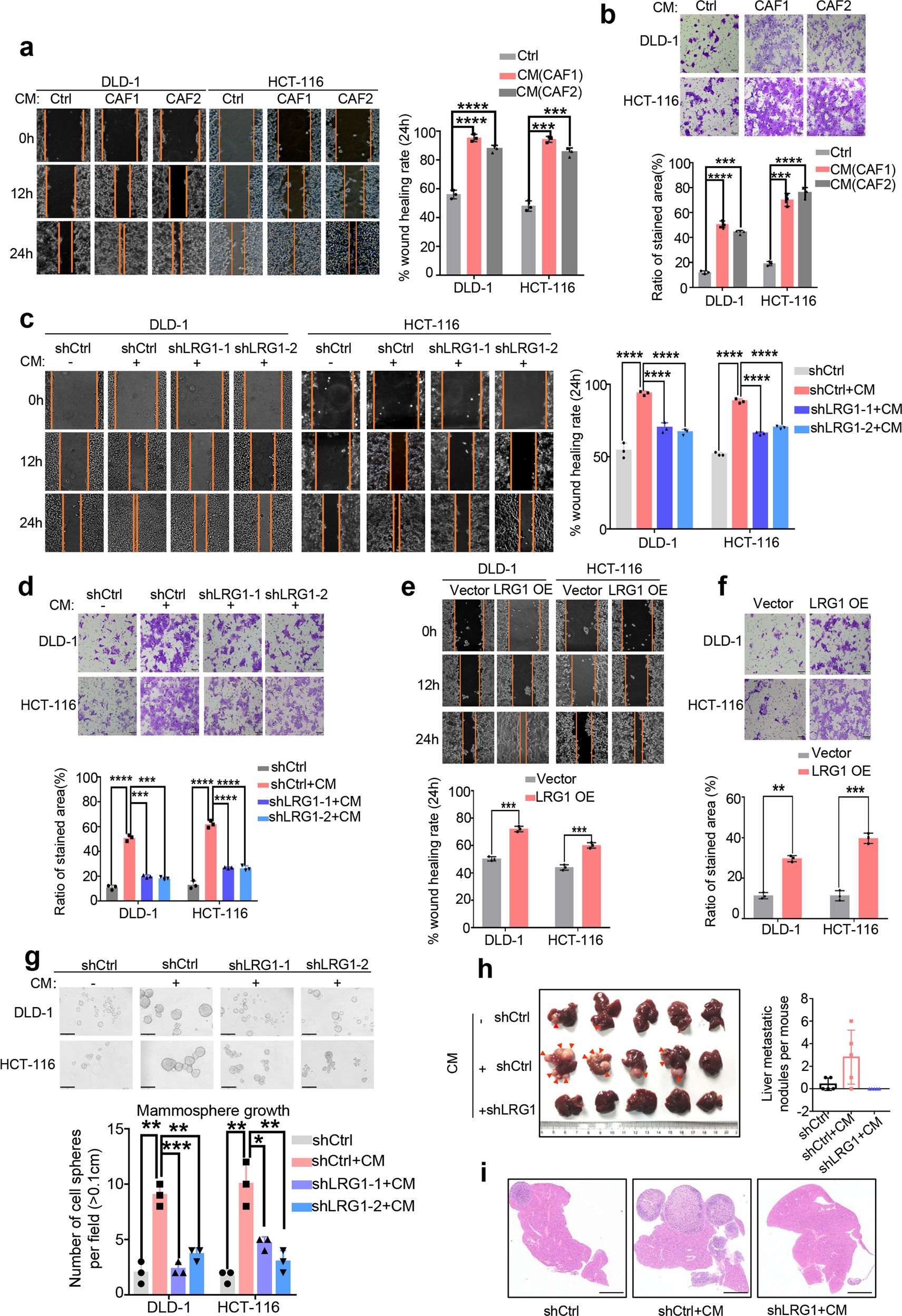 Fig. 2: Cancer-associated fibroblasts promote cell migration and invasion in a LRG1-dependent way.
