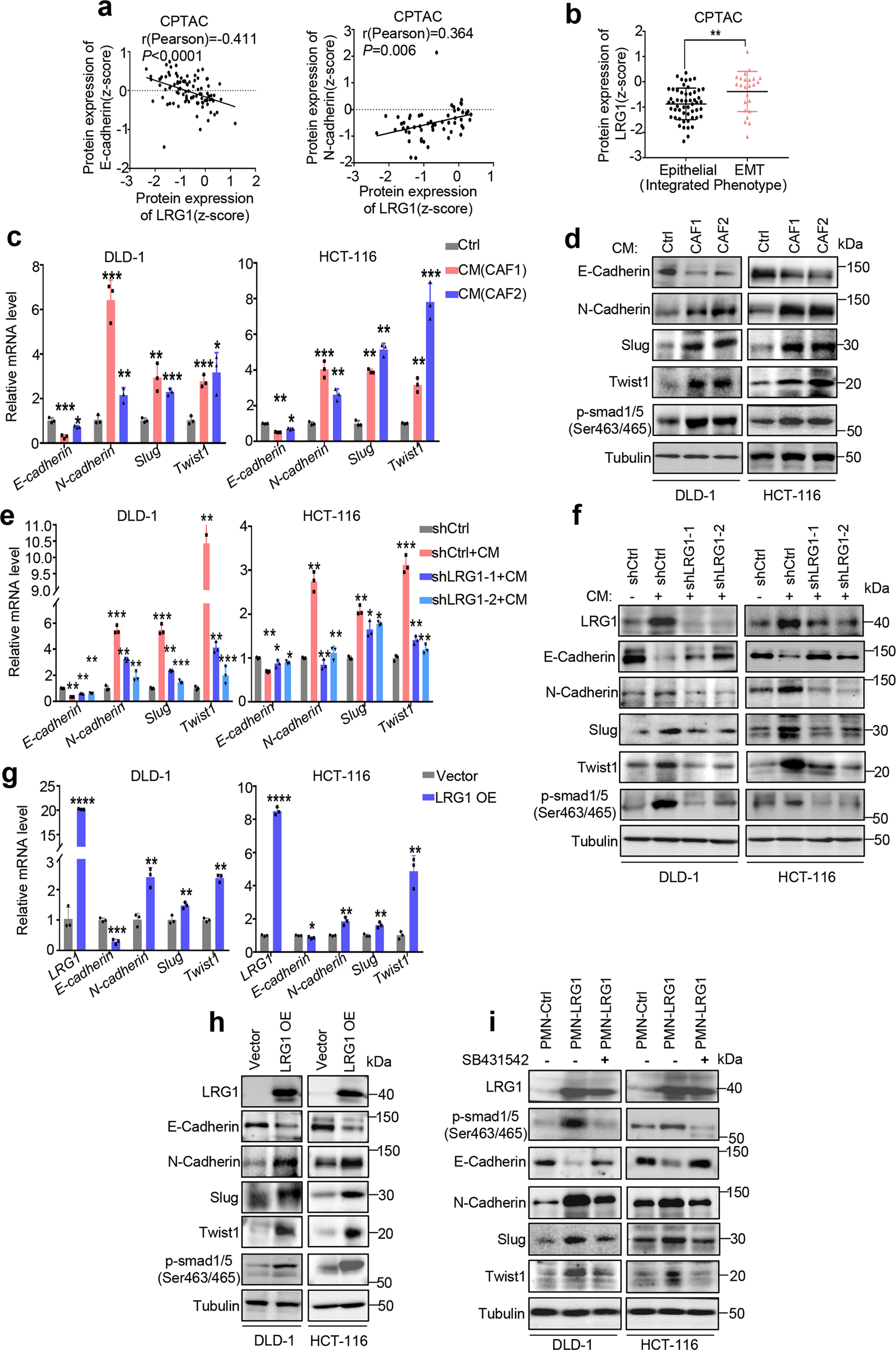 Fig. 3: CAFs-induced LRG1 promotes EMT.