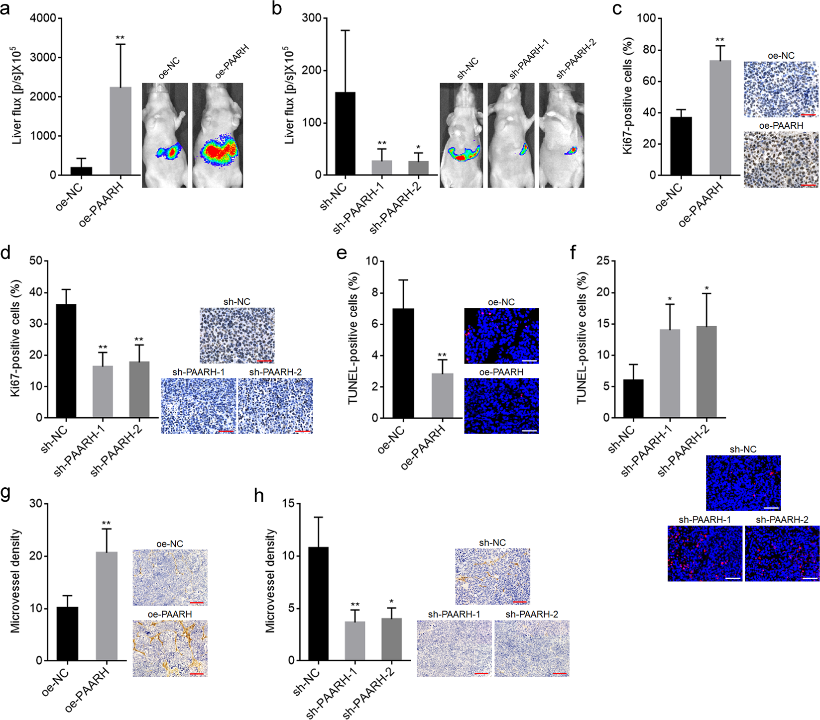 Fig. 4: PAARH facilitated HCC progression in vivo.