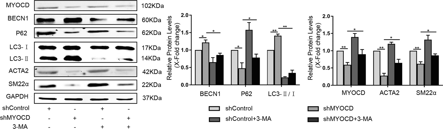 Fig. 2: Inhibition of autophagy in MYOCD-knockdown cells restored the expression of contractile proteins.