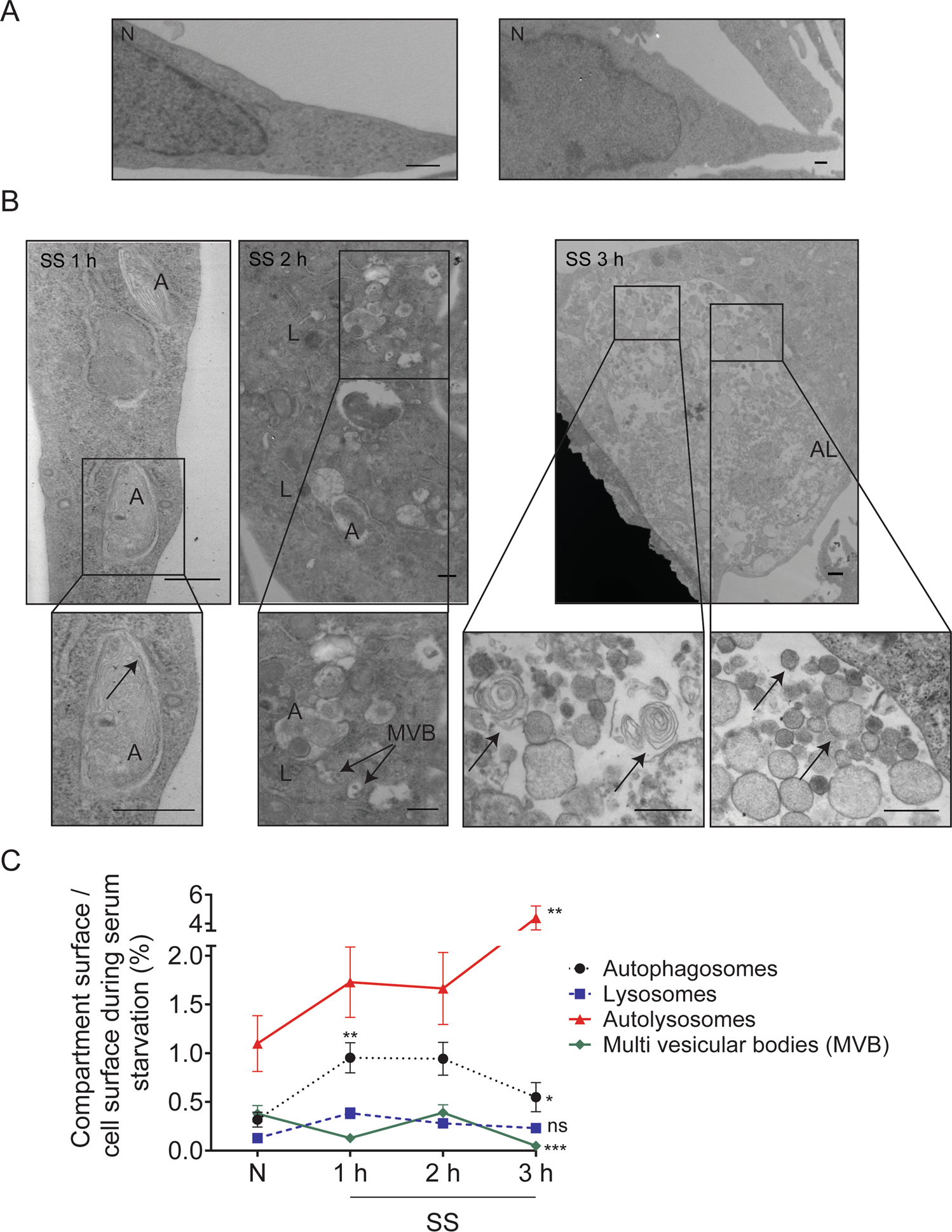 Fig. 2: Serum-starved human endothelial cells display large vacuolar networks containing membrane vesicles.