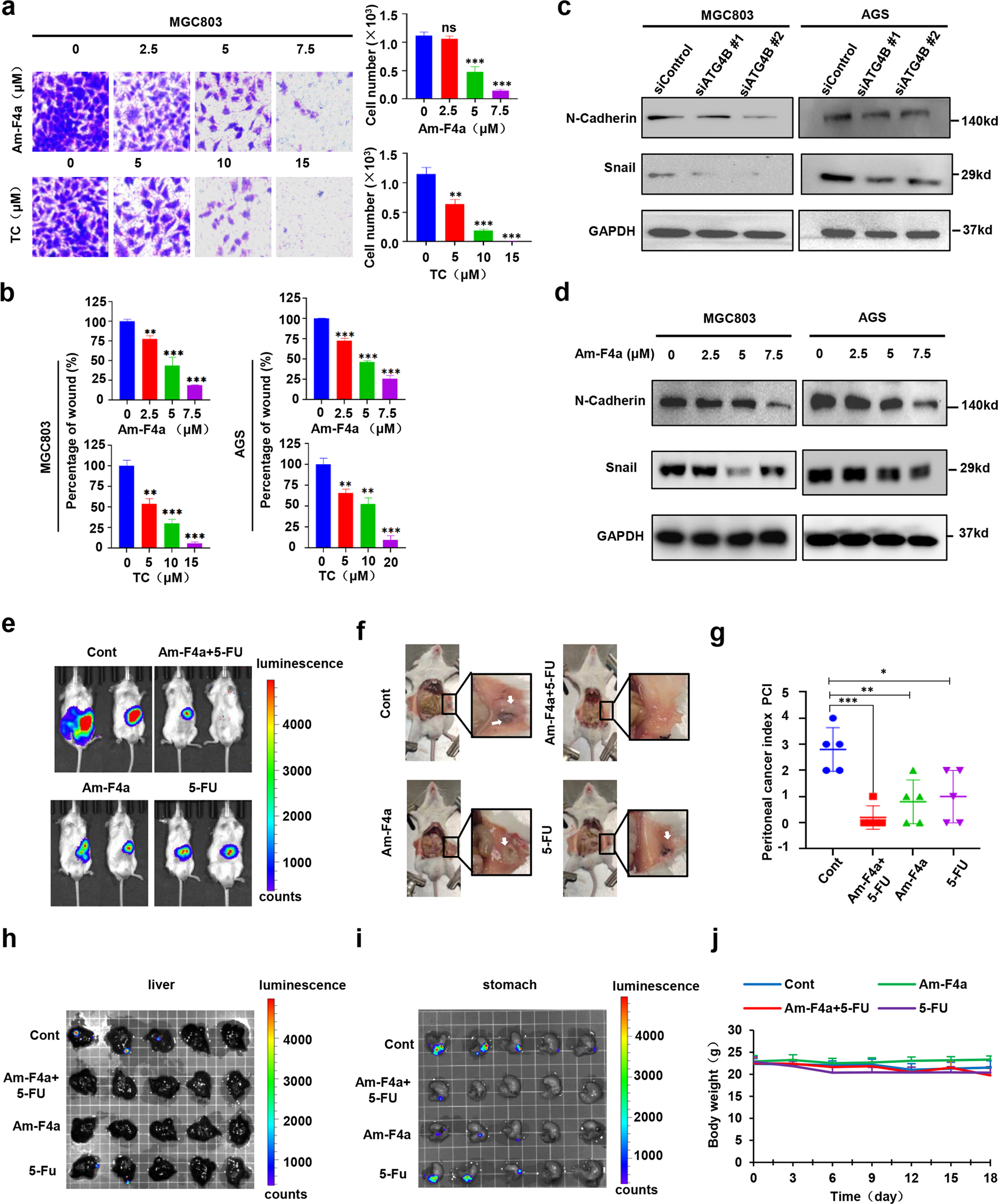 Fig. 6: ATG4B inhibition inhibits GC tumor metastasis.