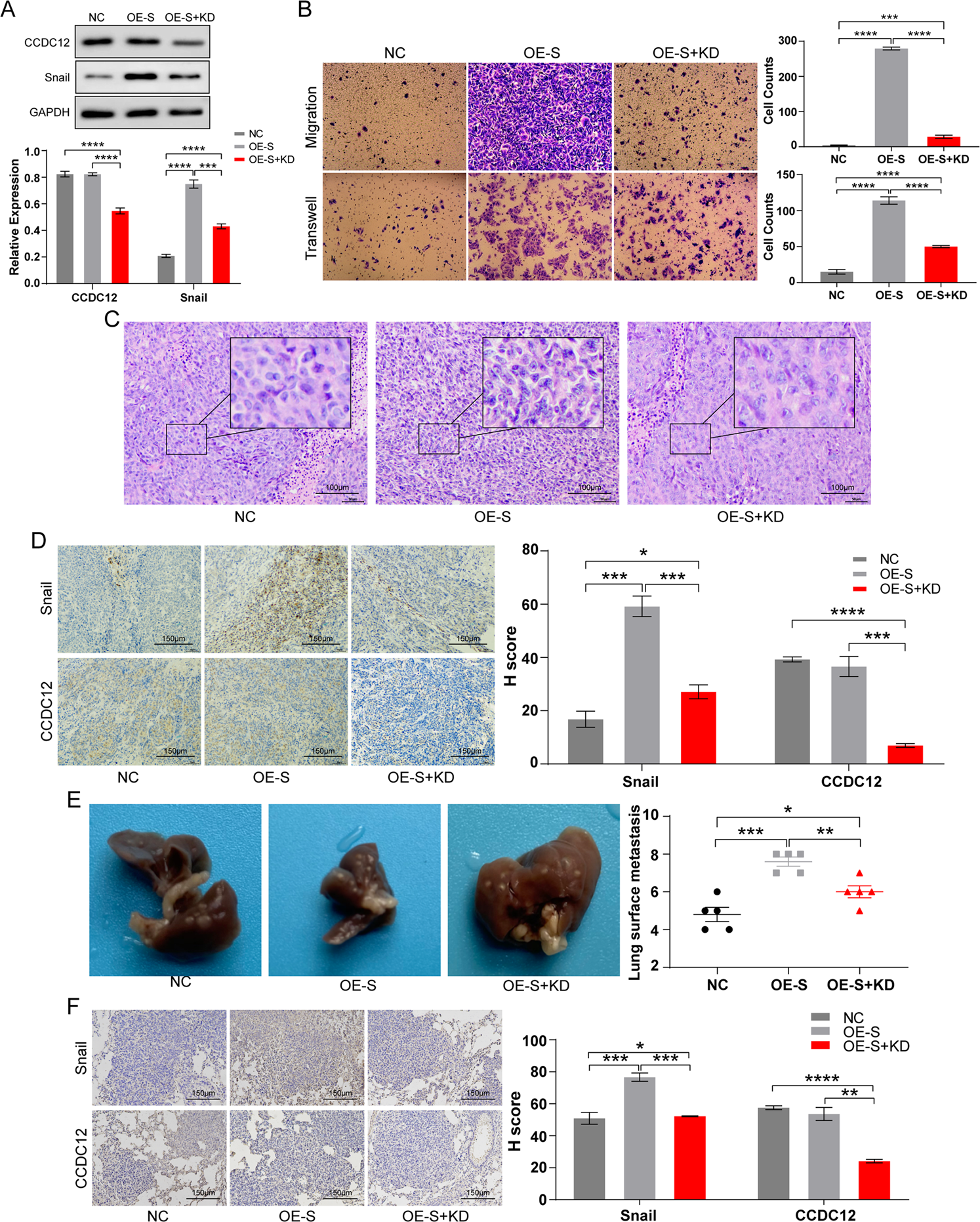 Fig. 5: CCDC12 regulates colon cancer progression through Snail.