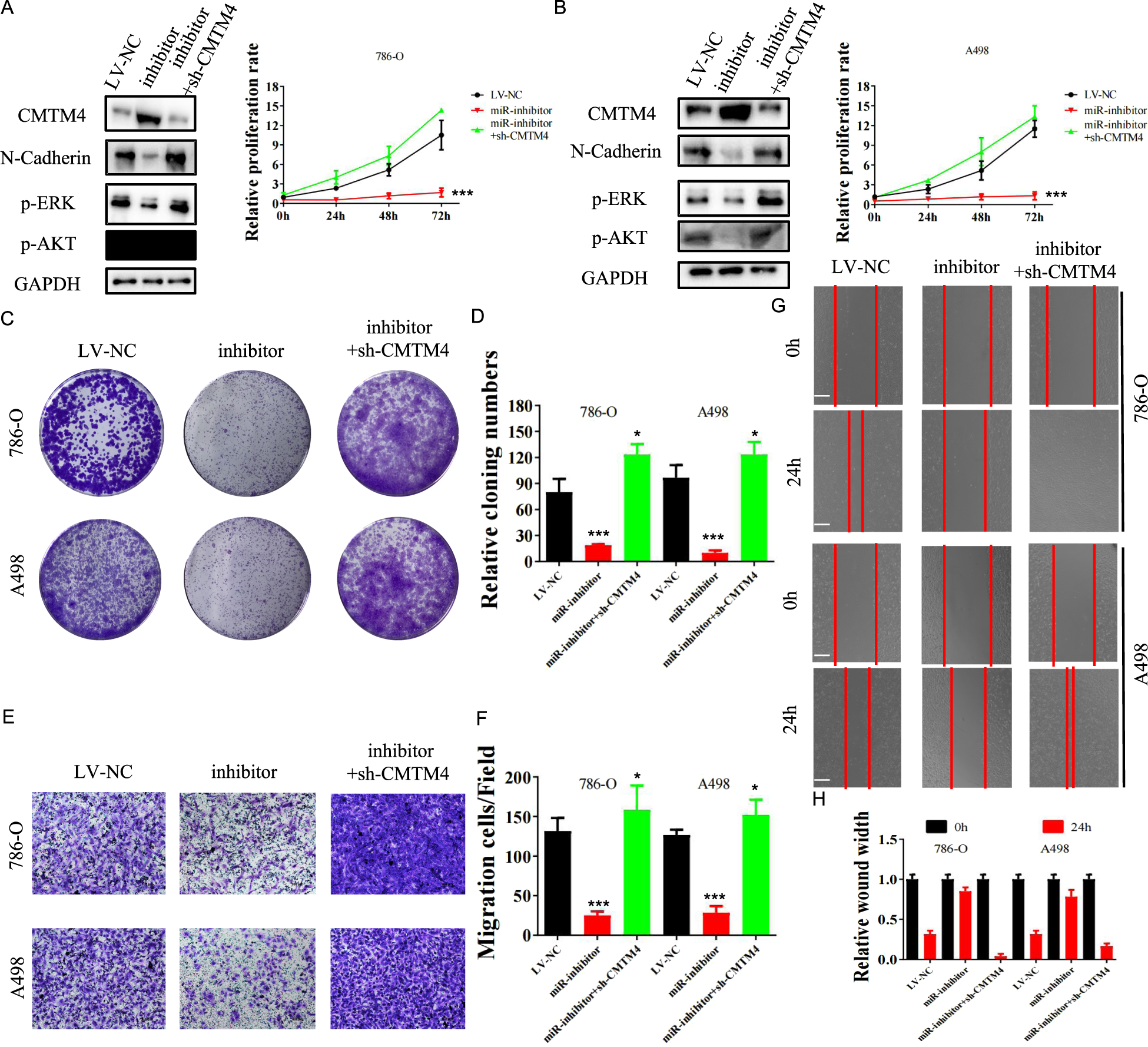 Fig. 6: Inhibition of miR-421 suppresses the proliferation, invasion, and migration of RCC cells in vitro, which were reversed by silencing CMTM4.
