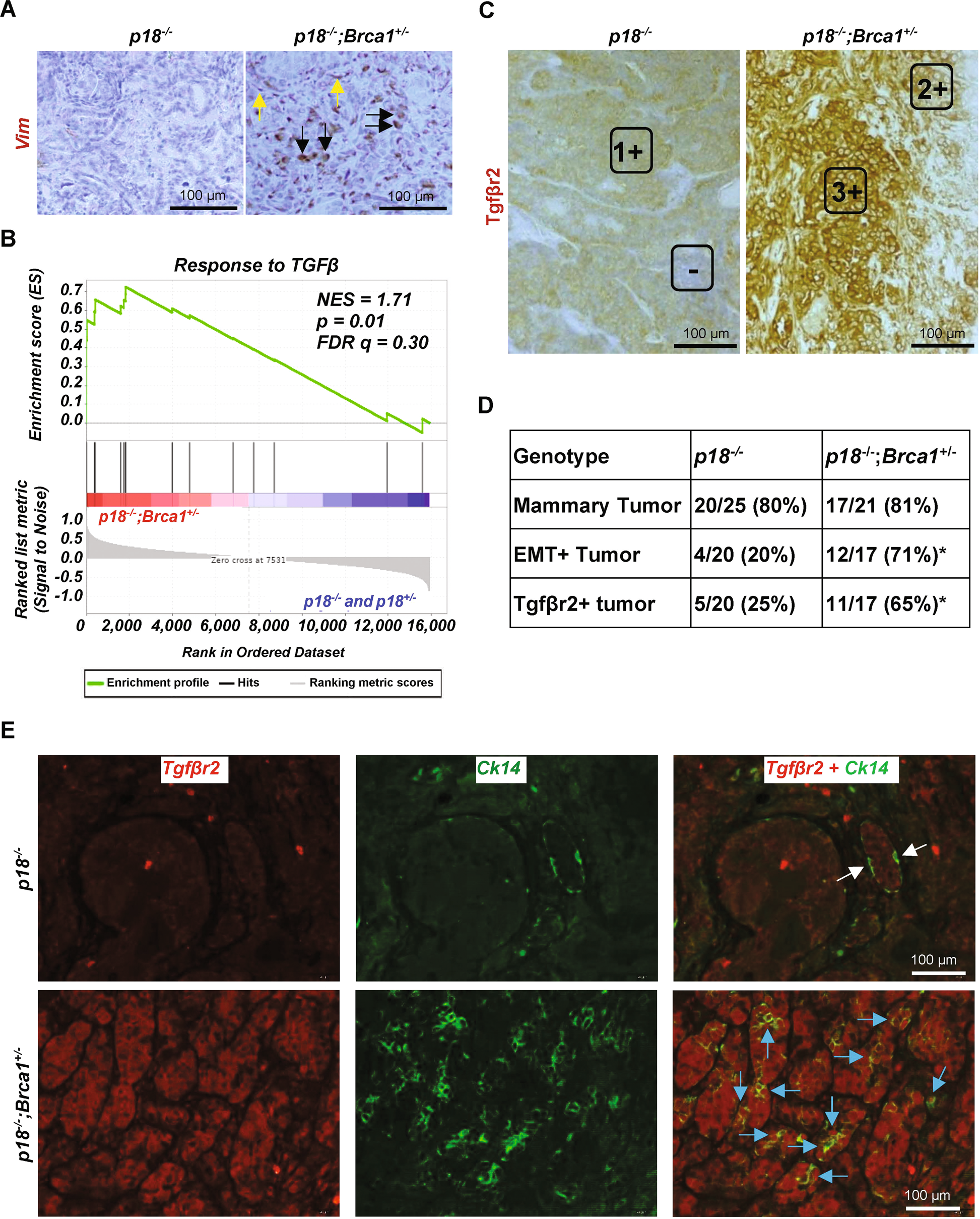 Fra-1/AP-1 induces EMT in mammary epithelial cells by modulating Zeb1/2 and  TGFβ expression