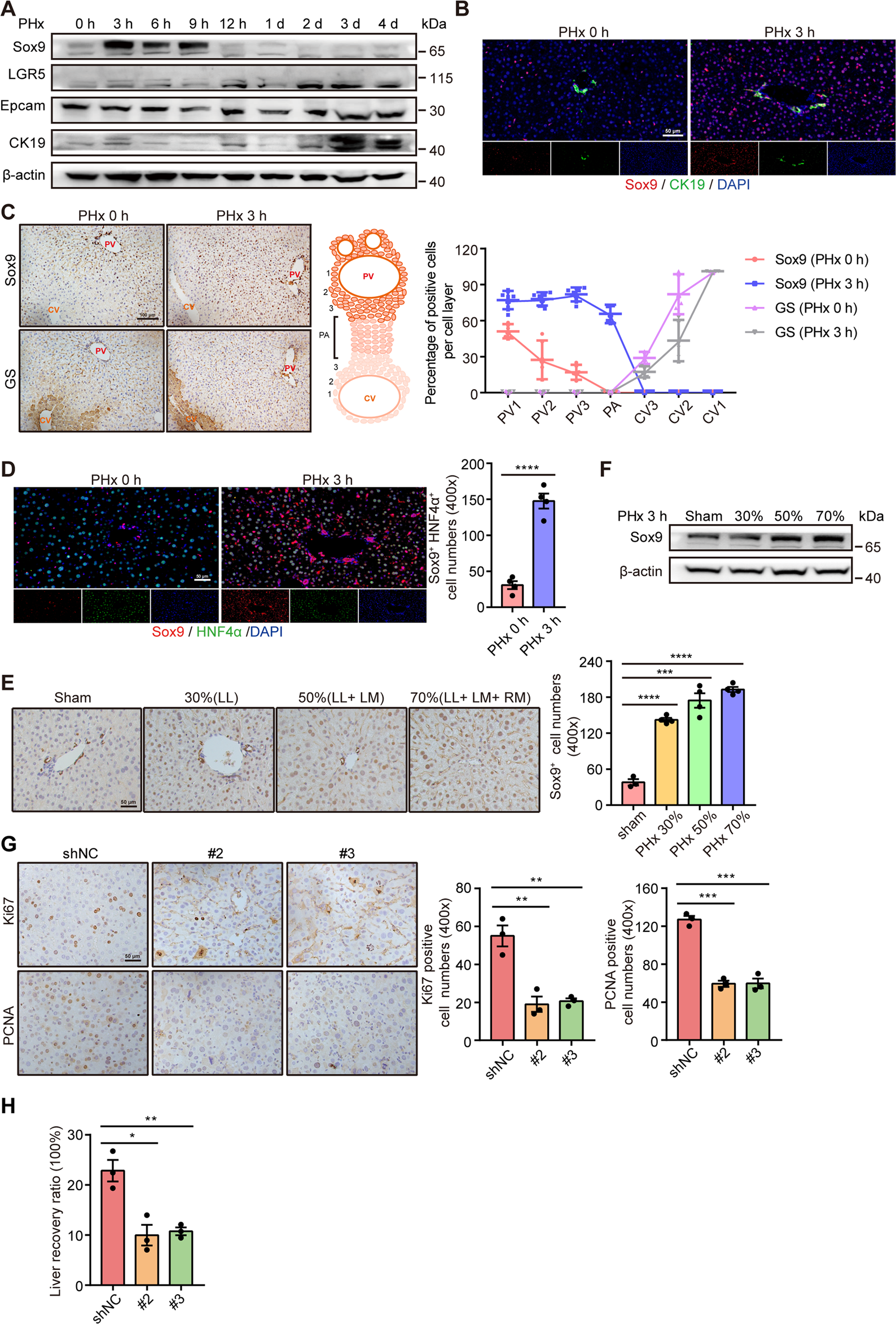 LPS/Bcl3/YAP1 signaling promotes Sox9+HNF4α+ hepatocyte-mediated liver  regeneration after hepatectomy | Cell Death & Disease