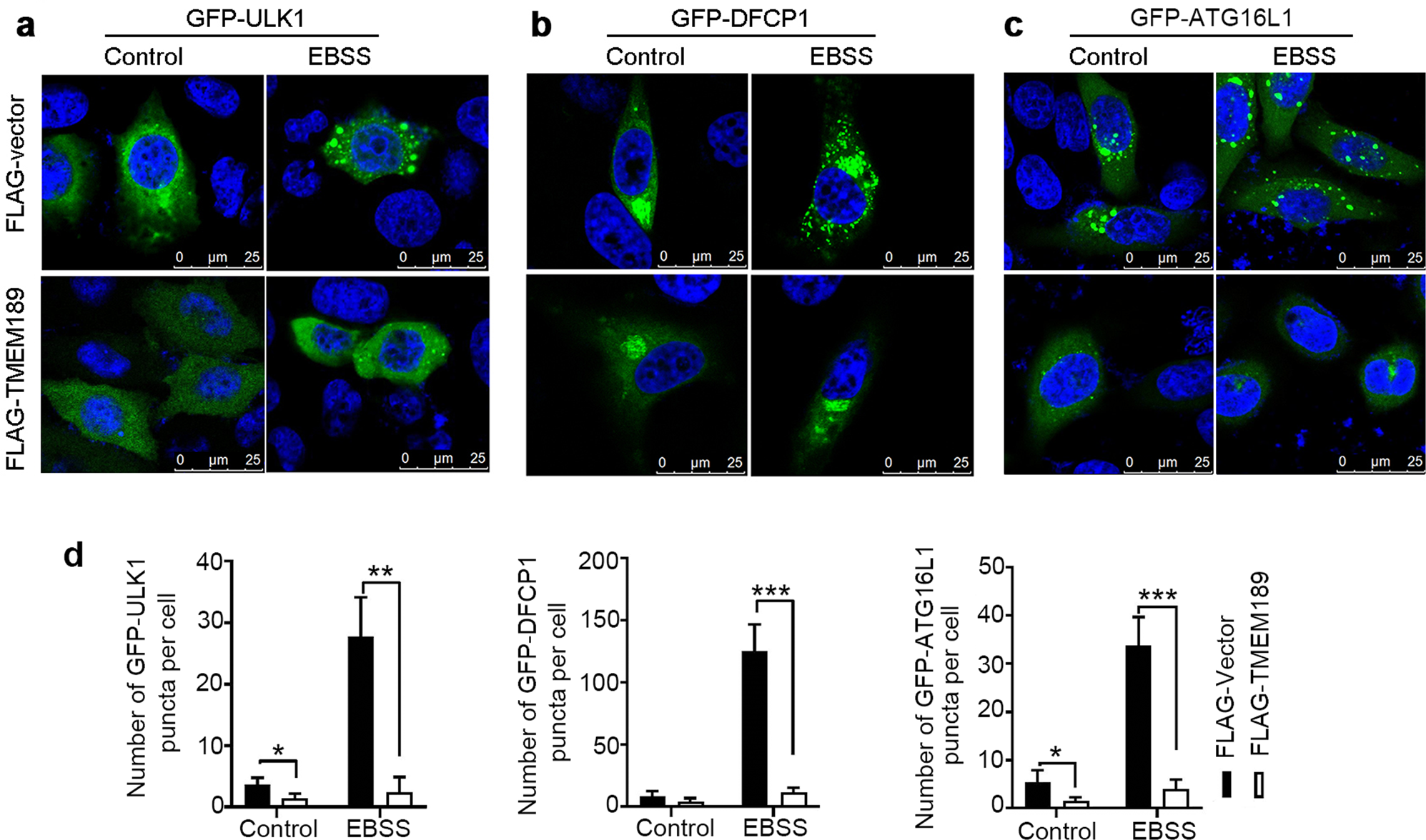Fig. 2: Overexpression of TMEM189 inhibits the formation of autophagosome.