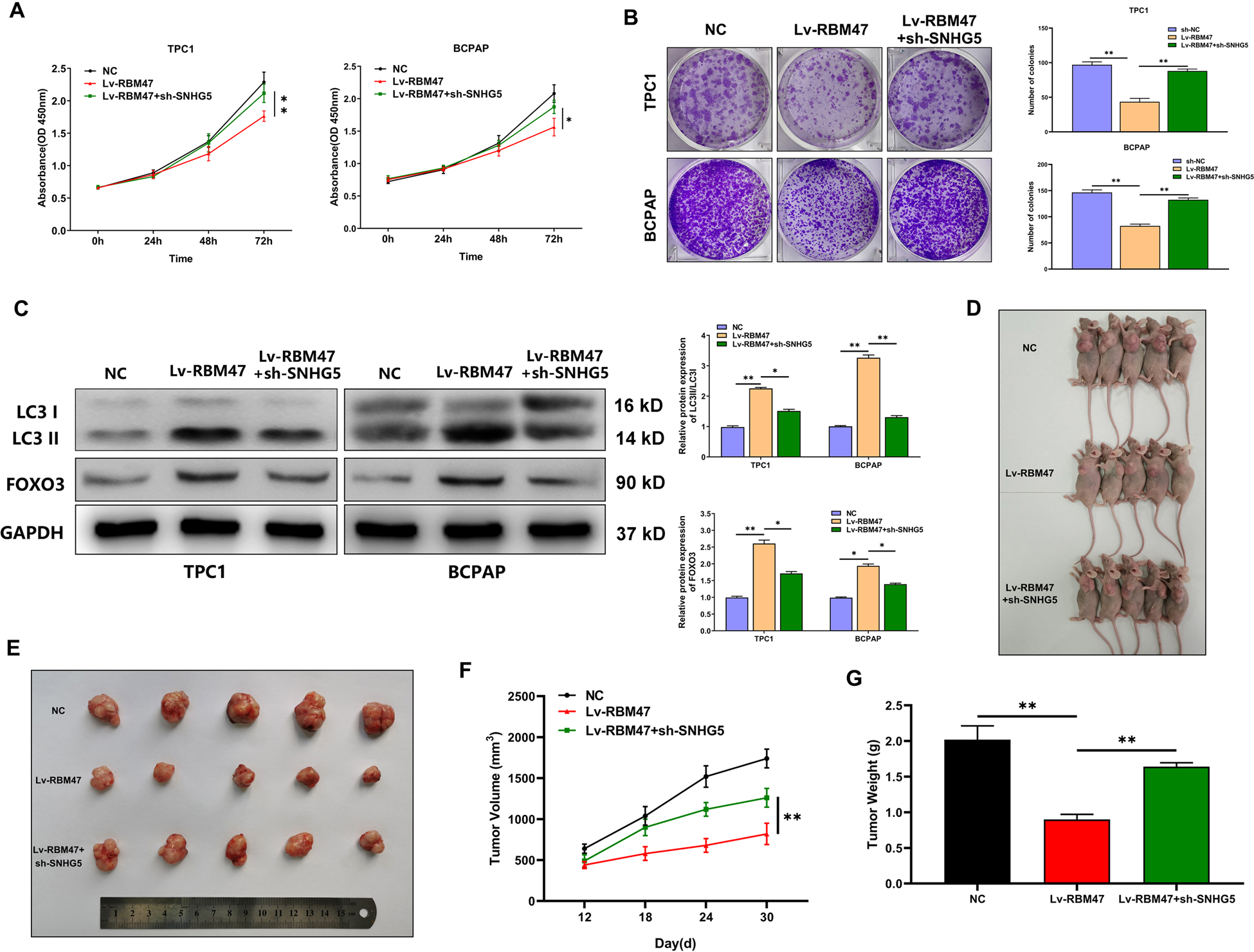 Fig. 4: RBM47 regulates PTC cell proliferation and autophagy via SNHG5 in vitro and in vivo.