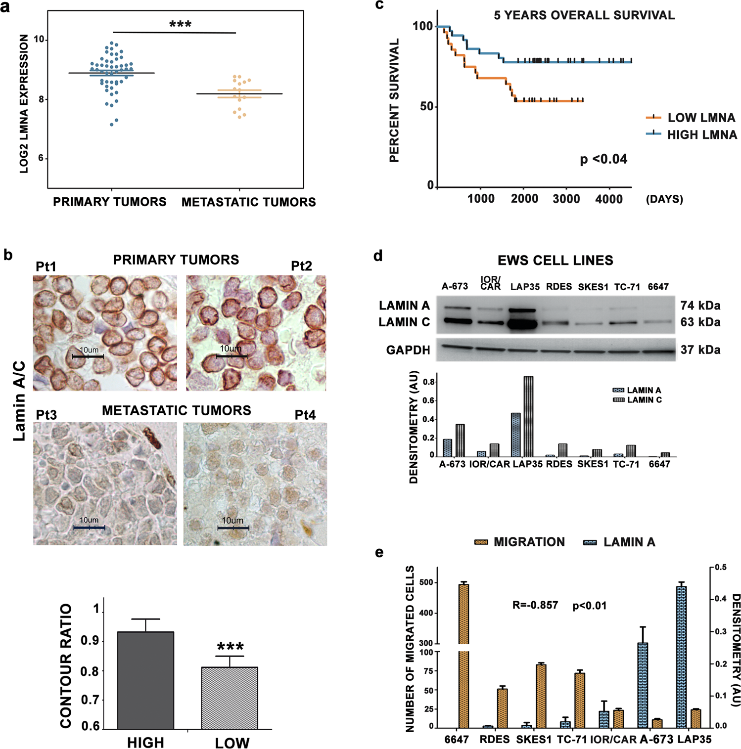 Lamin A and the LINC complex act as potential tumor suppressors in Ewing  Sarcoma | Cell Death & Disease