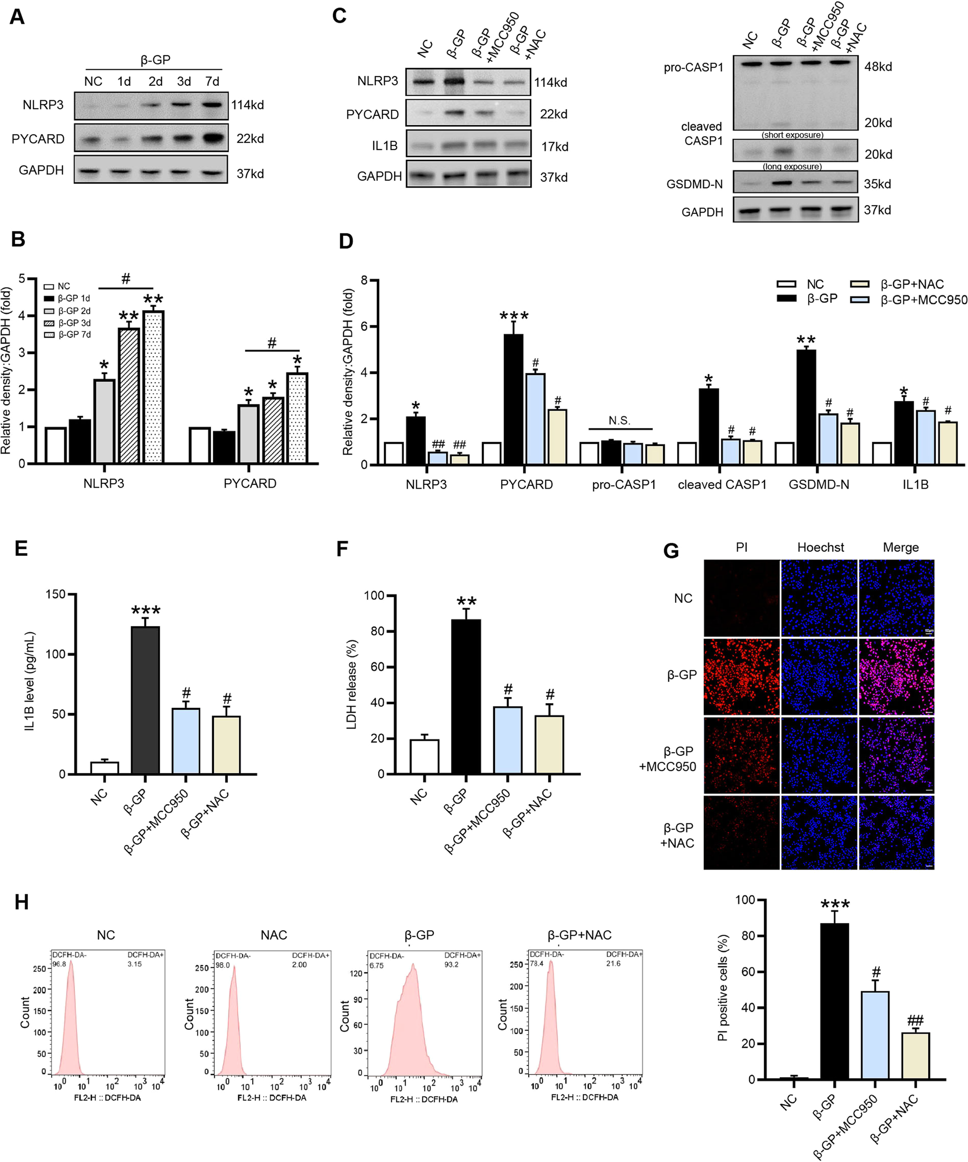 Fig. 3: ROS-mediated NLRP3 inflammasome activation is involved in β-GP-induced VSMC pyroptosis.