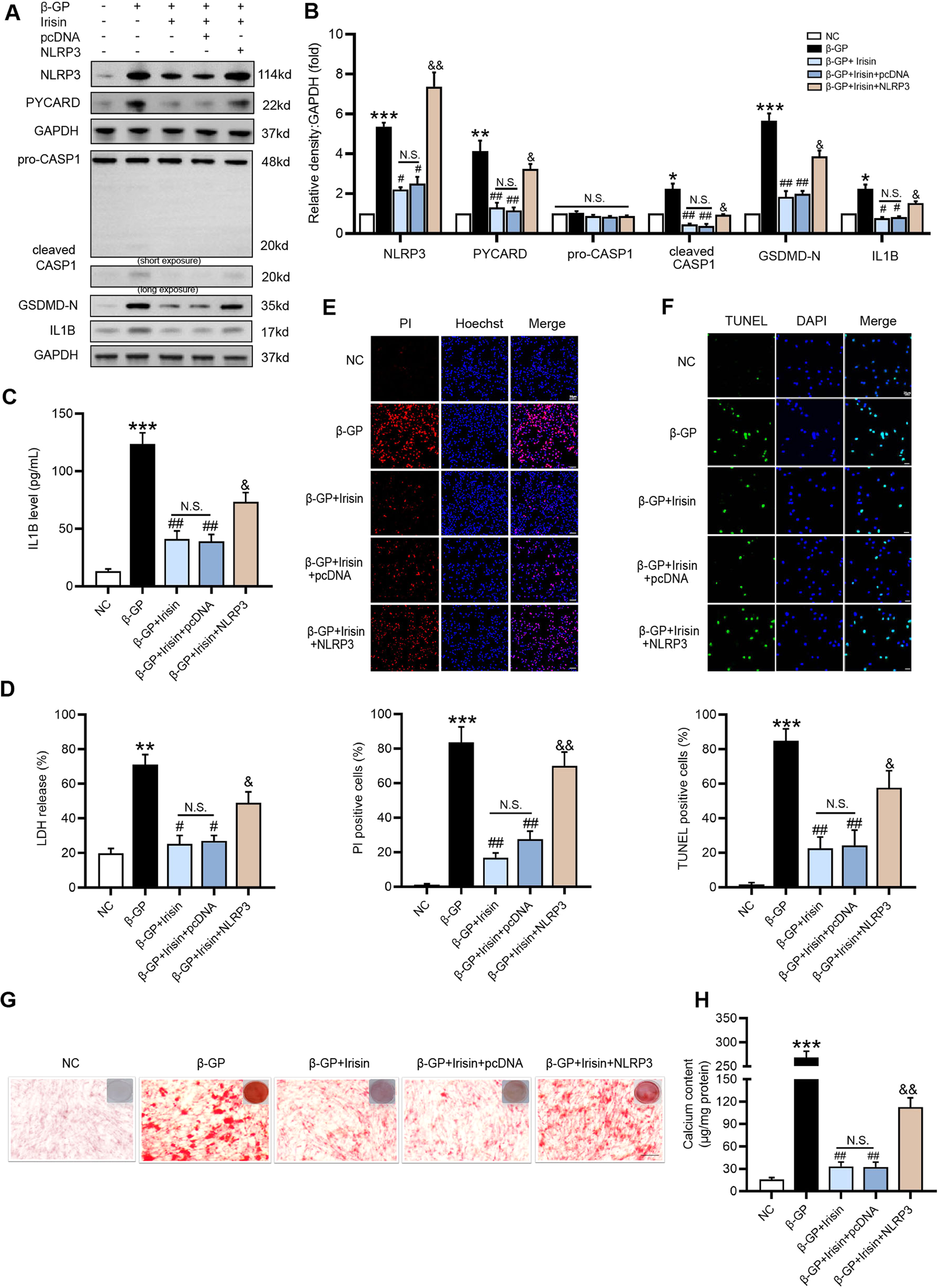 Fig. 4: Overexpression of Nlrp3 attenuates the inhibitory effect of Irisin on β-GP-induced VSMC pyroptosis and calcification.