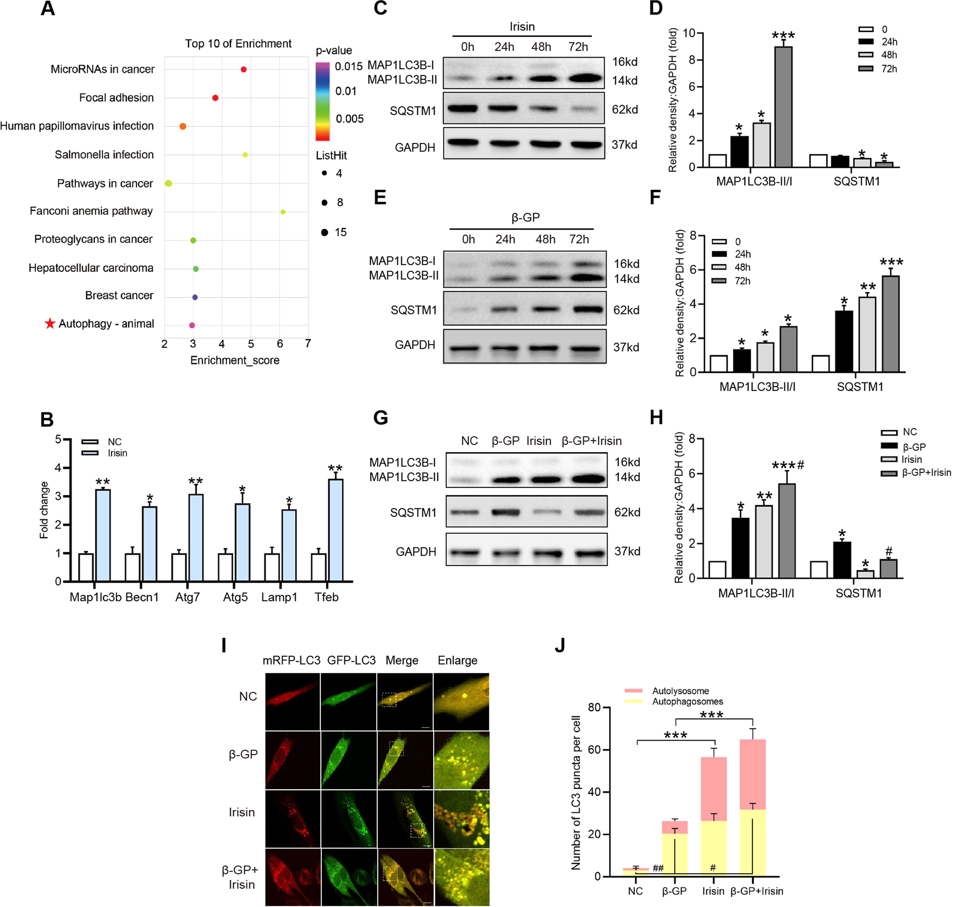 Fig. 5: Irisin treatment induces autophagy and restores autophagic flux in calcified VSMCs.