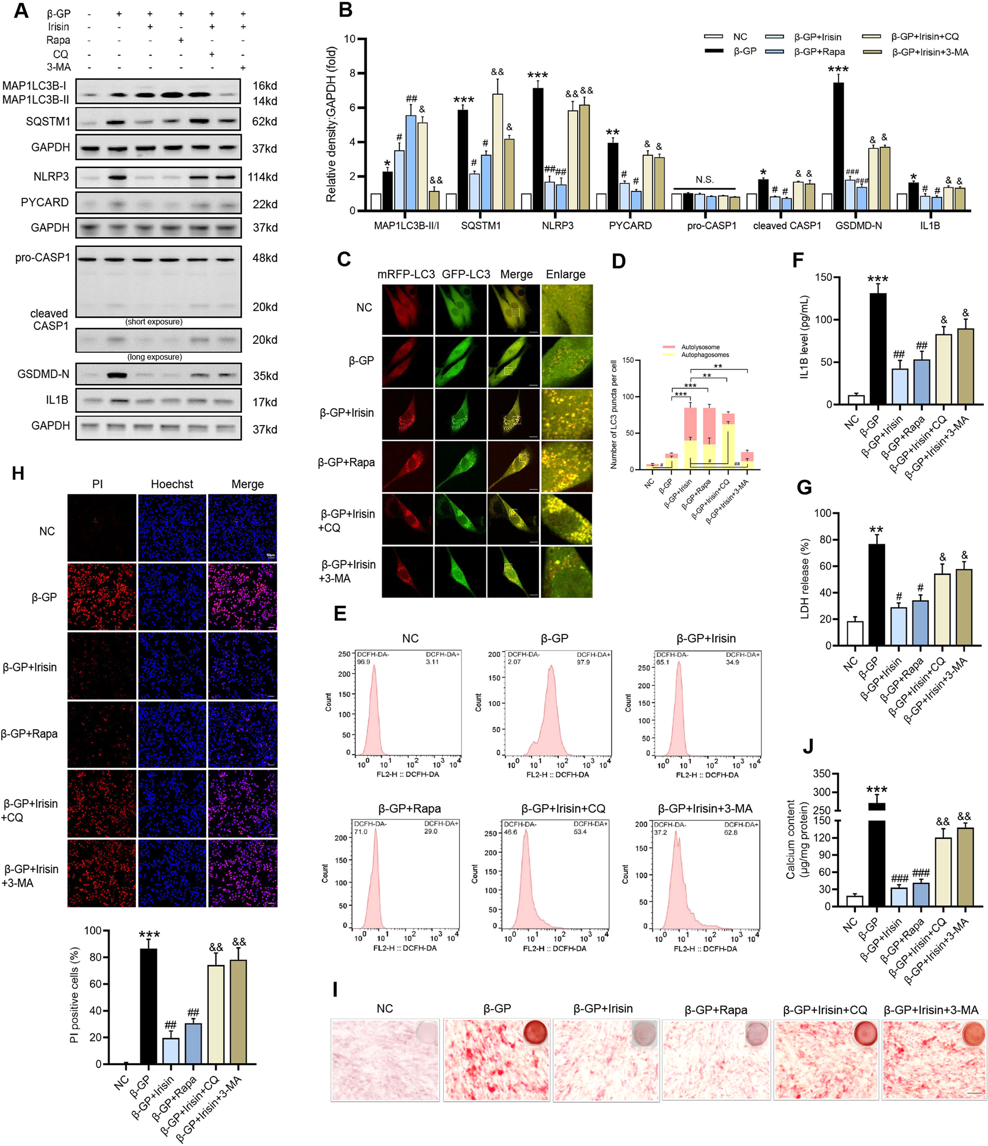 Fig. 6: Irisin protects VSMCs from β-GP-induced pyroptotic cell death and calcification by promoting autophagic flux.