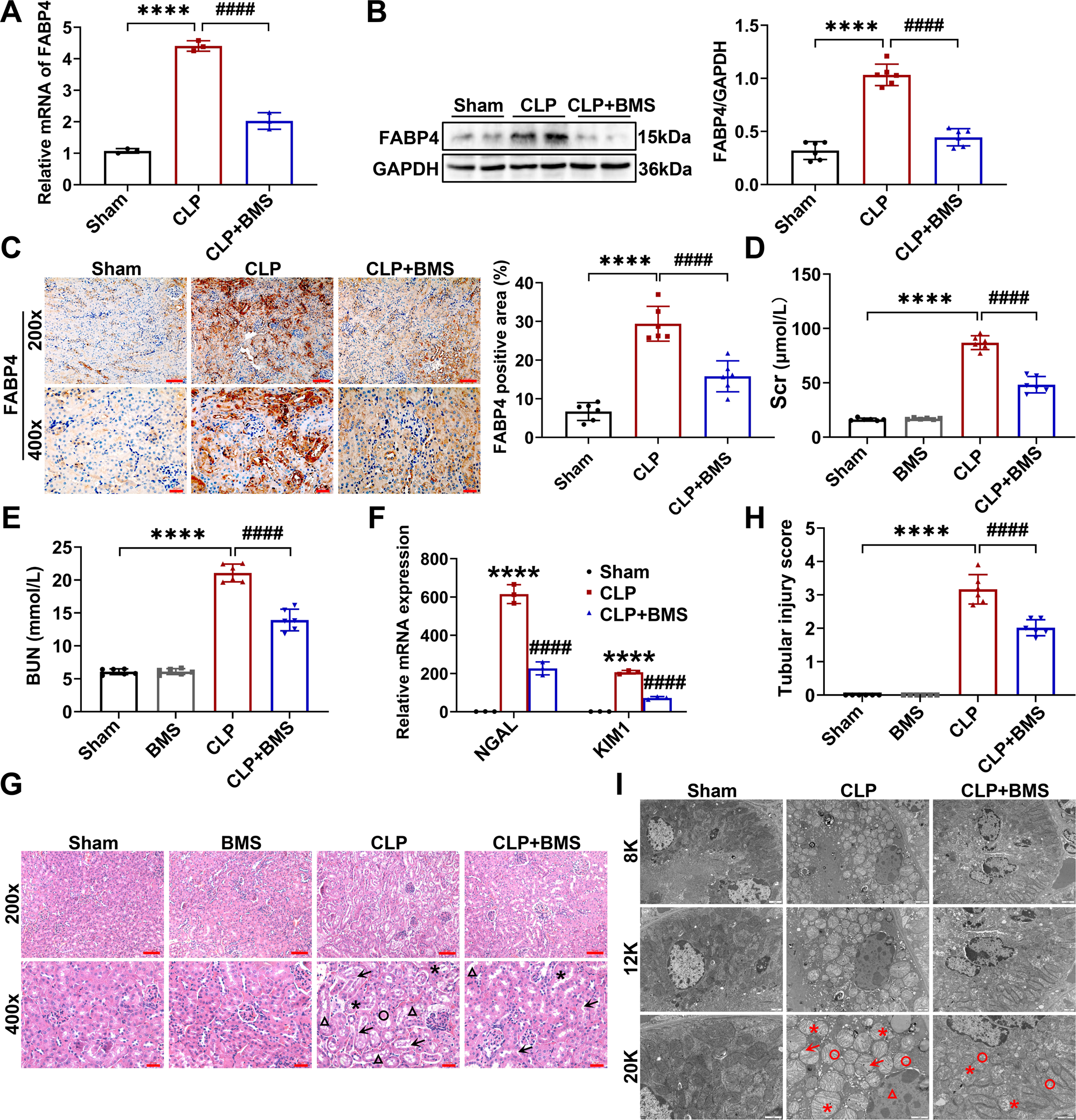 Fig. 2: FABP4 inhibitor BMS309403 treatment alleviated CLP-induced septic AKI in mice.