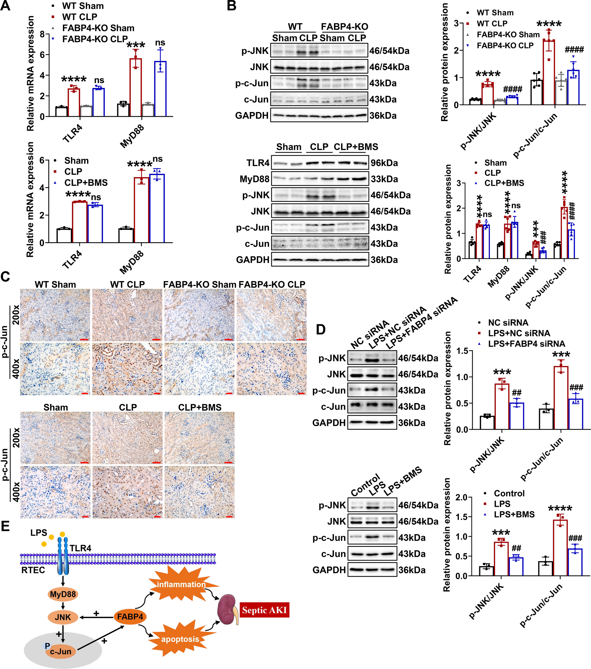 Fig. 8: Tubular FABP4 formed a positive feedback loop with c-Jun in septic AKI.