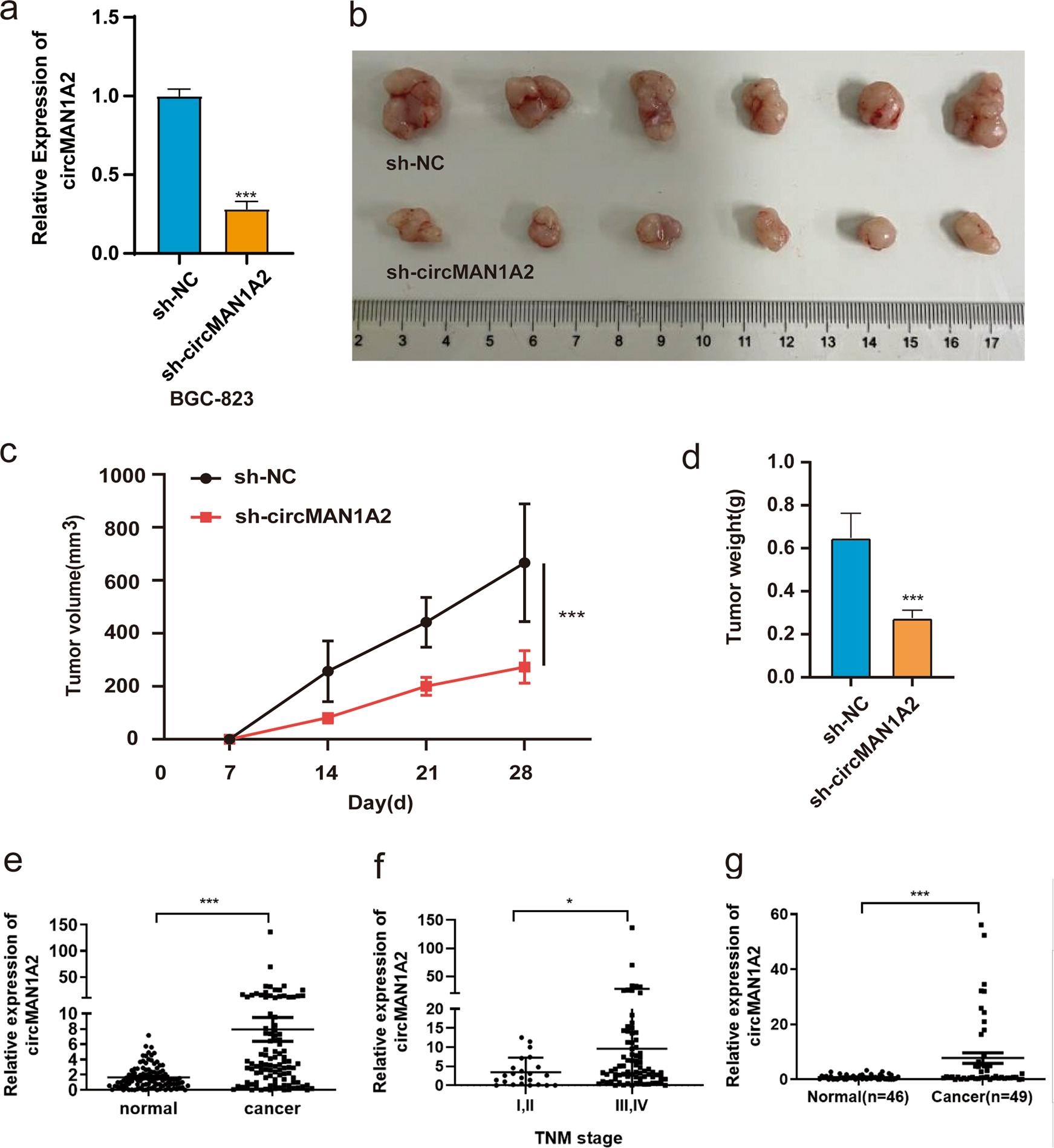 Fig. 6: CircMAN1A2 knockdown inhibited xenograft tumour growth in vivo and the clinical relevance of circMAN1A2 in GC.