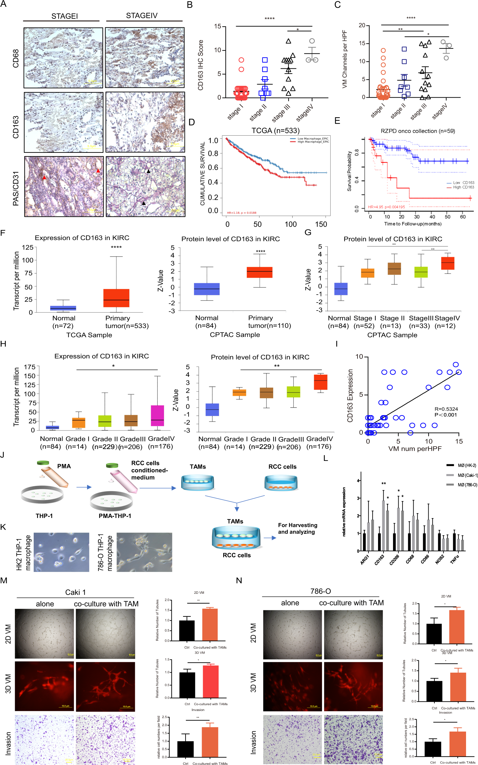 Tumor-associated macrophage-derived exosomes transmitting miR-193a-5p  promote the progression of renal cell carcinoma via TIMP2-dependent  vasculogenic mimicry | Cell Death & Disease