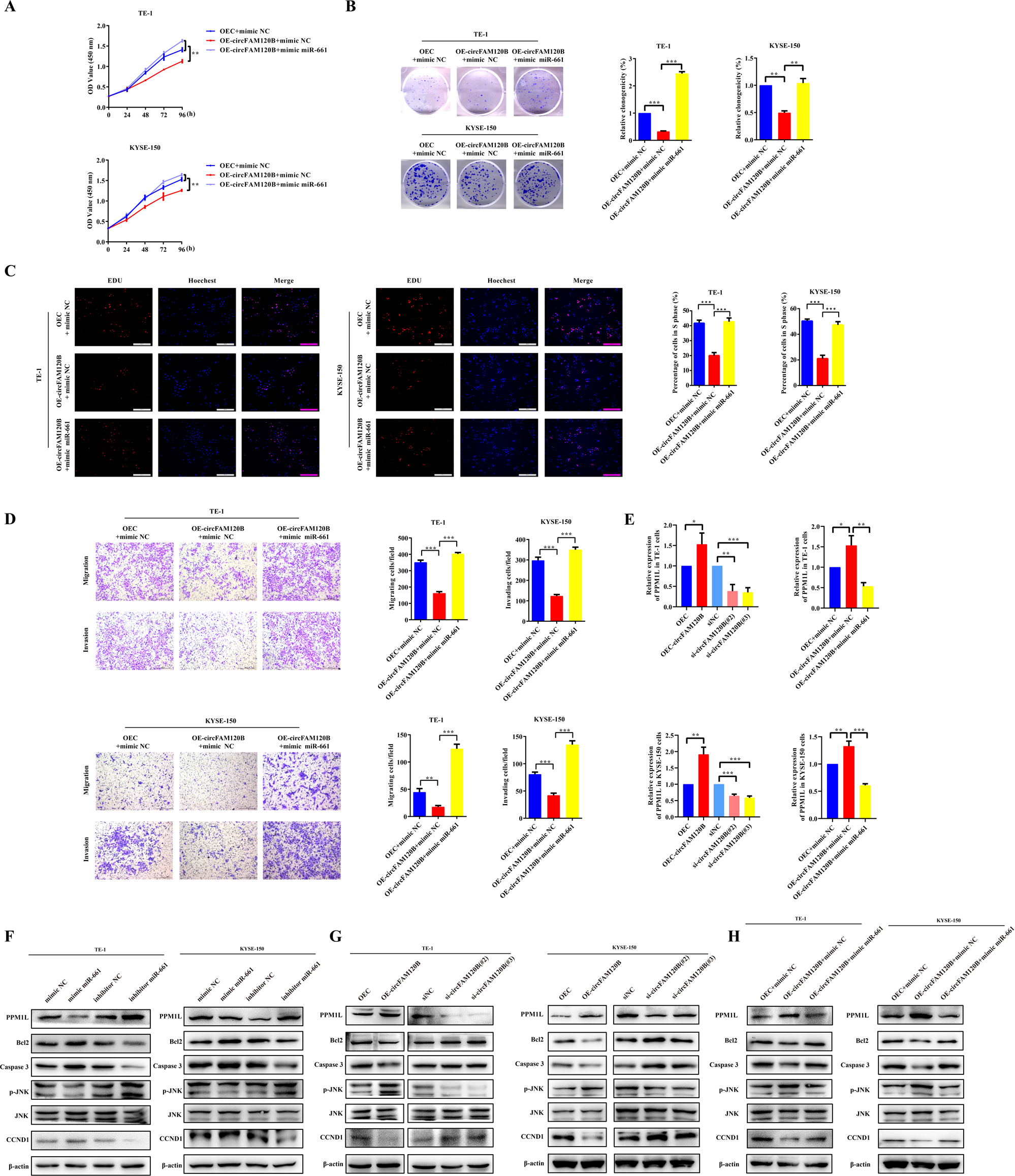 Fig. 4: circFAM120B inhibits the tumorigenicity of ESCC by binding with miR-661 to restore PPM1L expression.