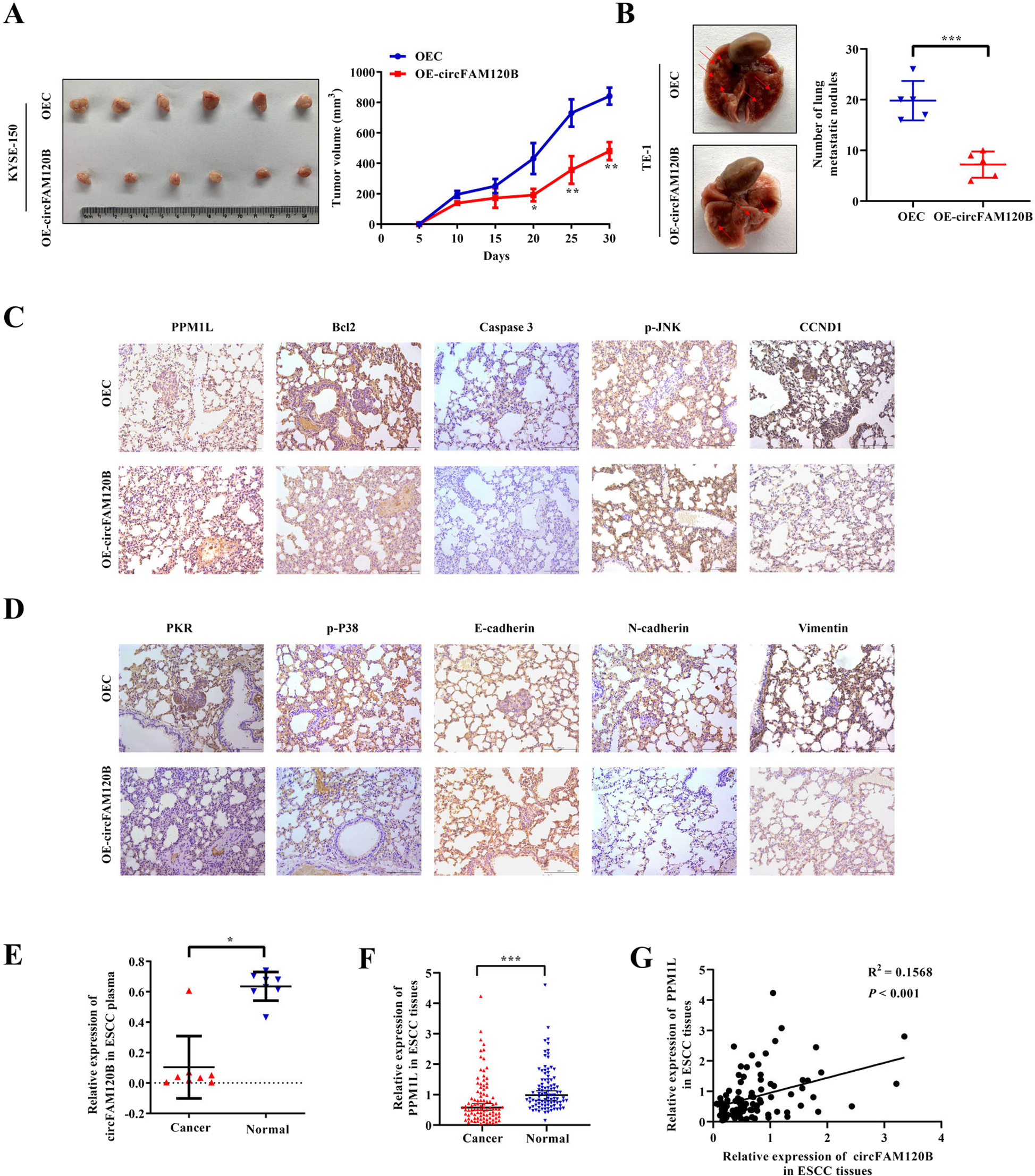 Fig. 6: circFAM120B depresses the tumorigenicity of ESCC in vivo and is associated with PPM1L in clinical samples.