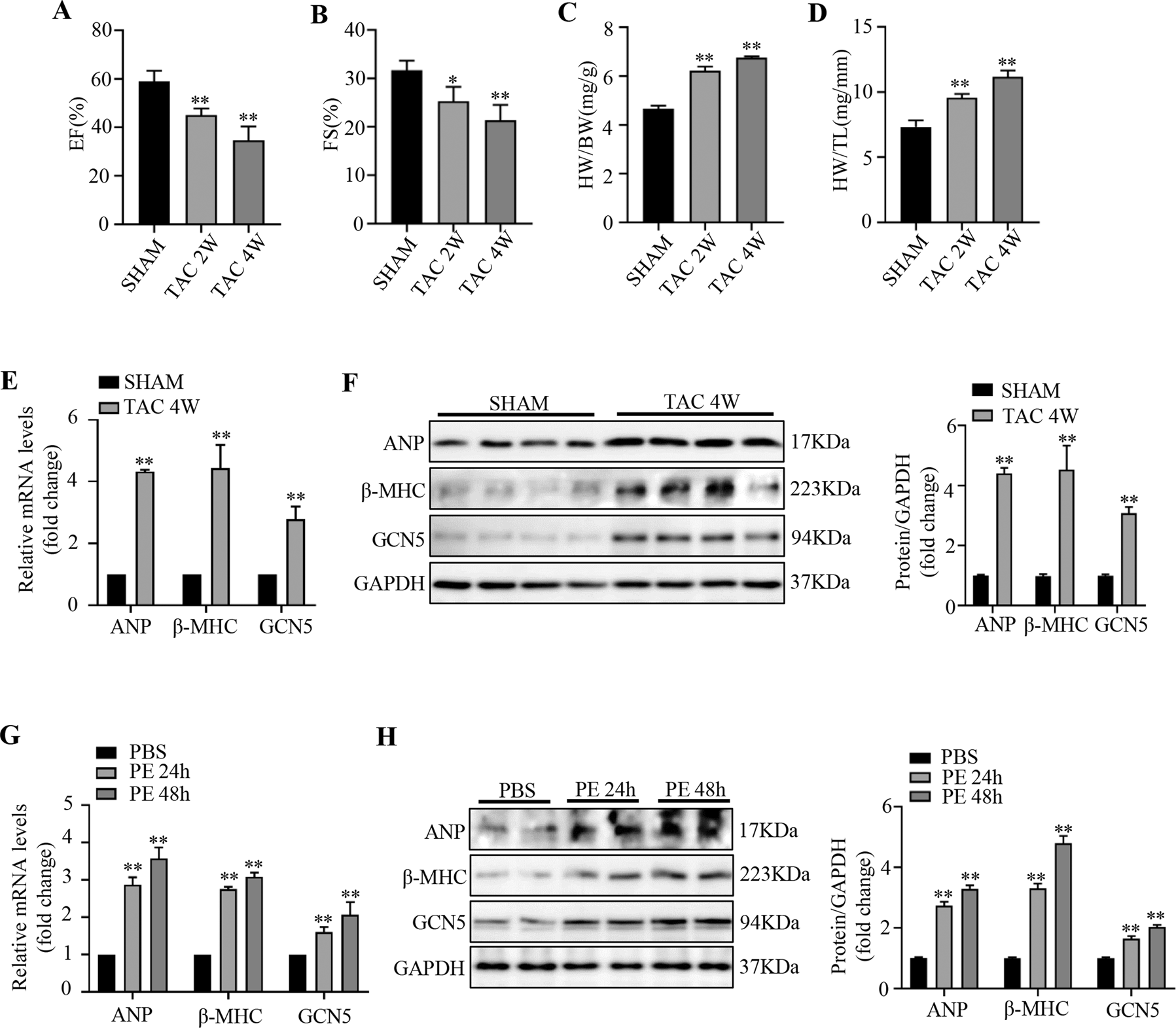 Fig. 1: GCN5 expression is upregulated in hypertrophic mouse hearts and cardiomyocytes.