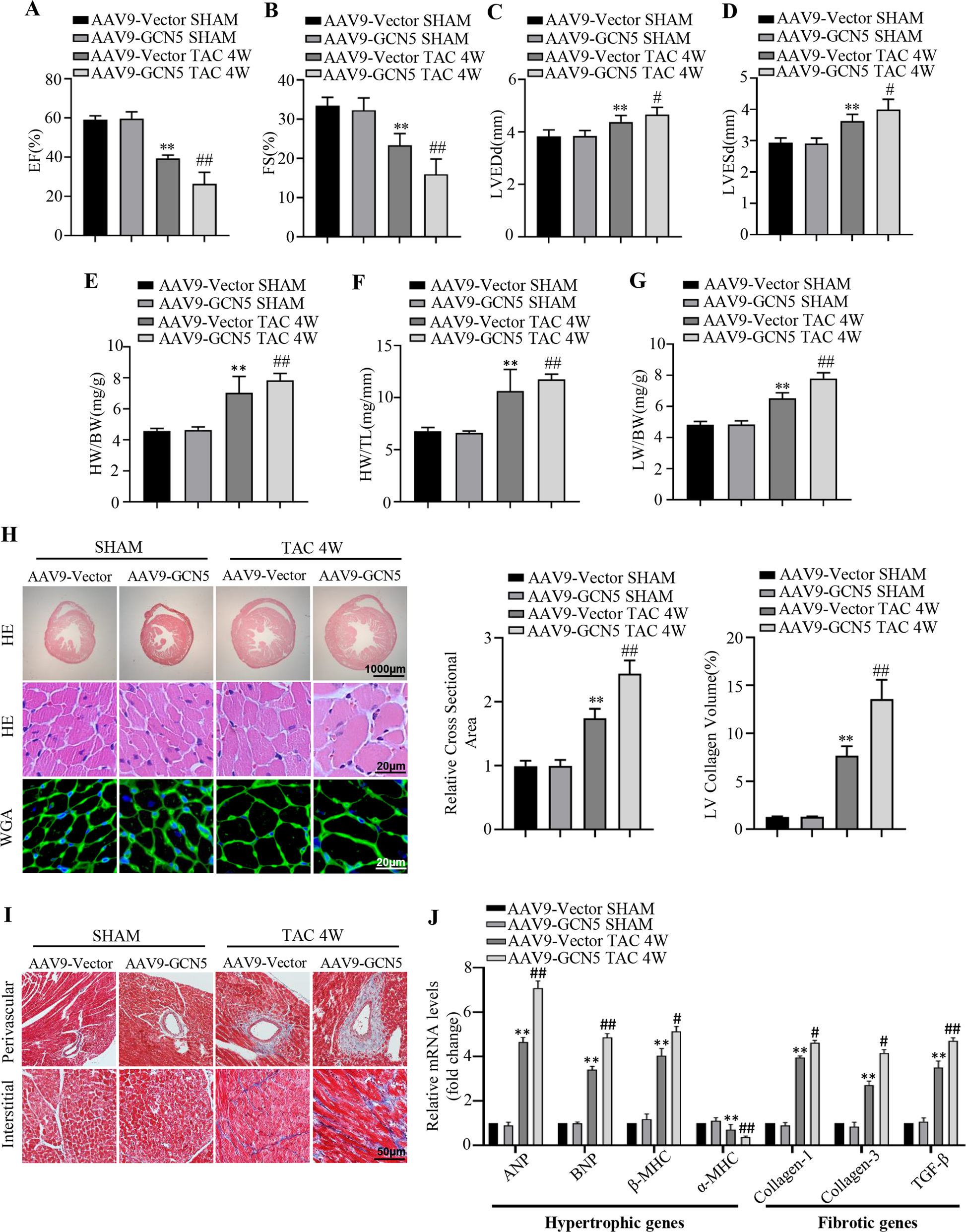 Fig. 2: GCN5 overexpression accelerates pressure overload-induced cardiac hypertrophy and dysfunction.