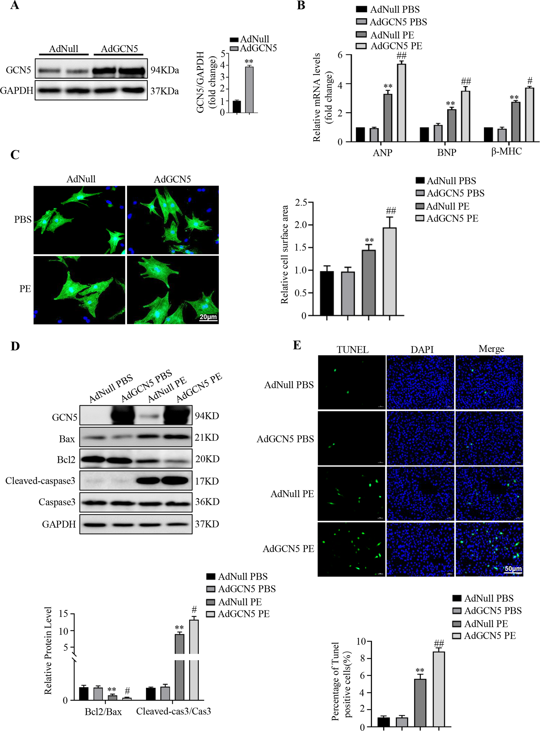 Fig. 3: GCN5 overexpression accelerates PE-induced cardiomyocyte hypertrophy and apoptosis.