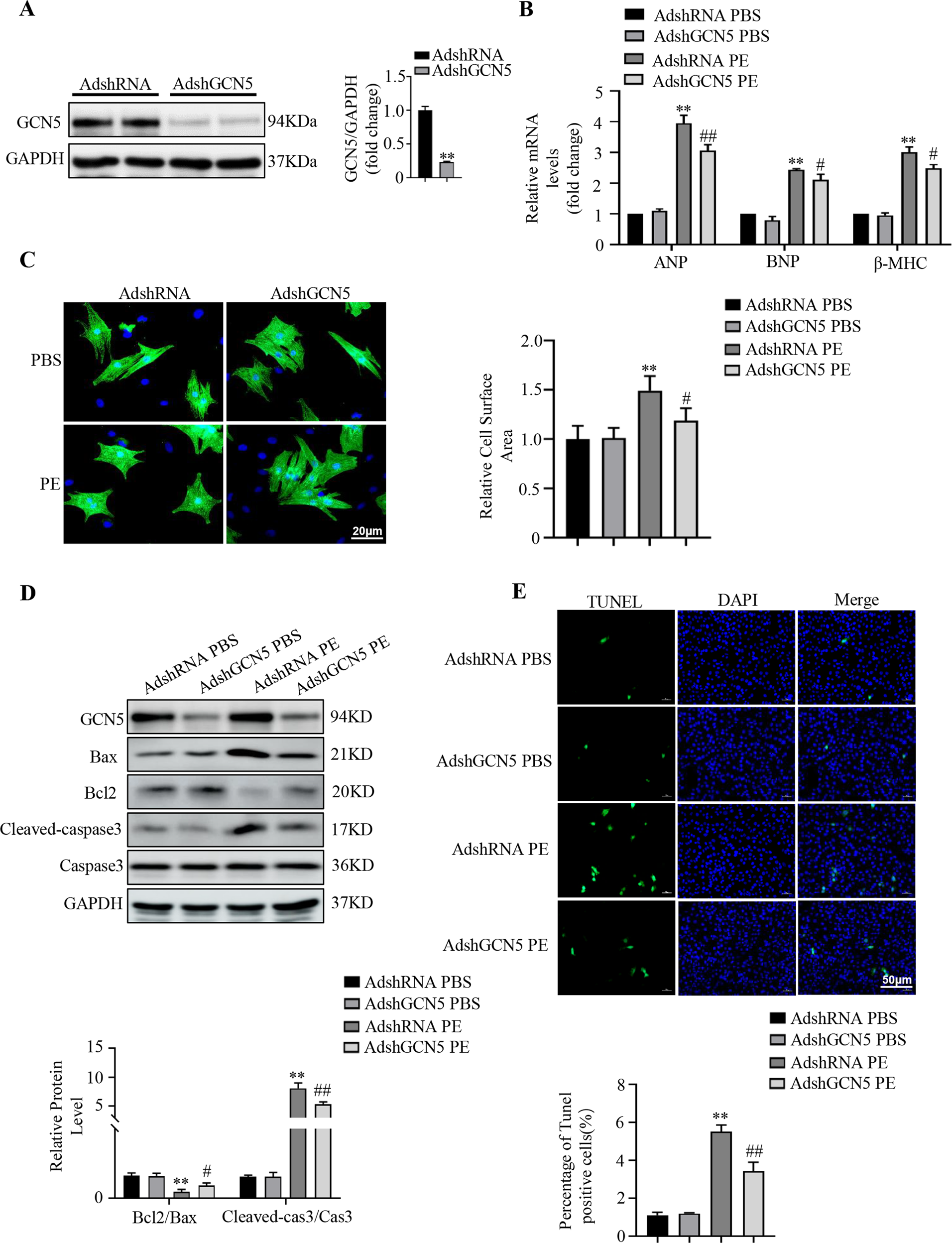 Fig. 4: GCN5 deficiency alleviates PE-induced cardiomyocyte hypertrophy and apoptosis.