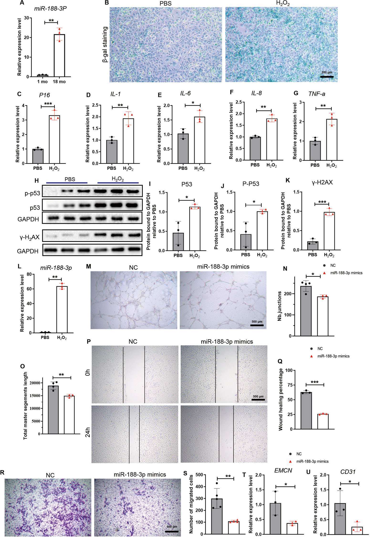 Fig. 2: miR-188-3p expression increased during senescence and inhibited angiogenesis in vitro.