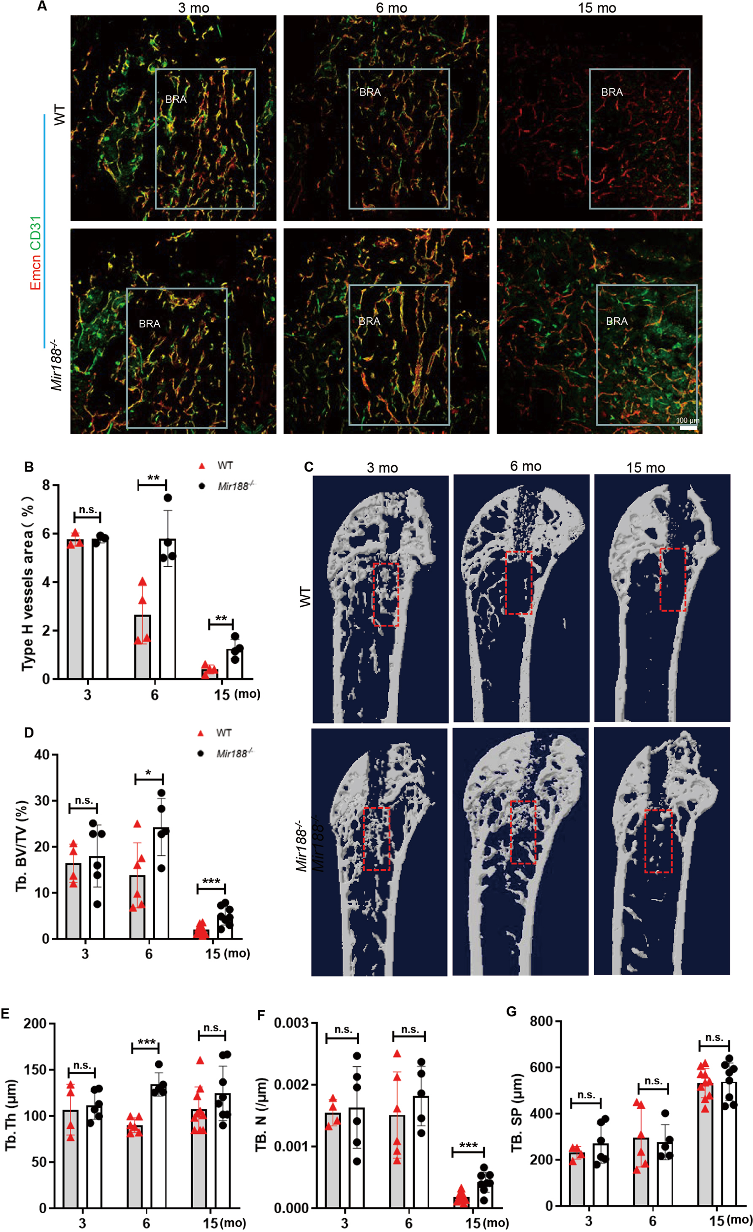 Fig. 5: Mice with knockout miR-188 showed more type H vessels and accelerated bone regeneration during bone damage repair.