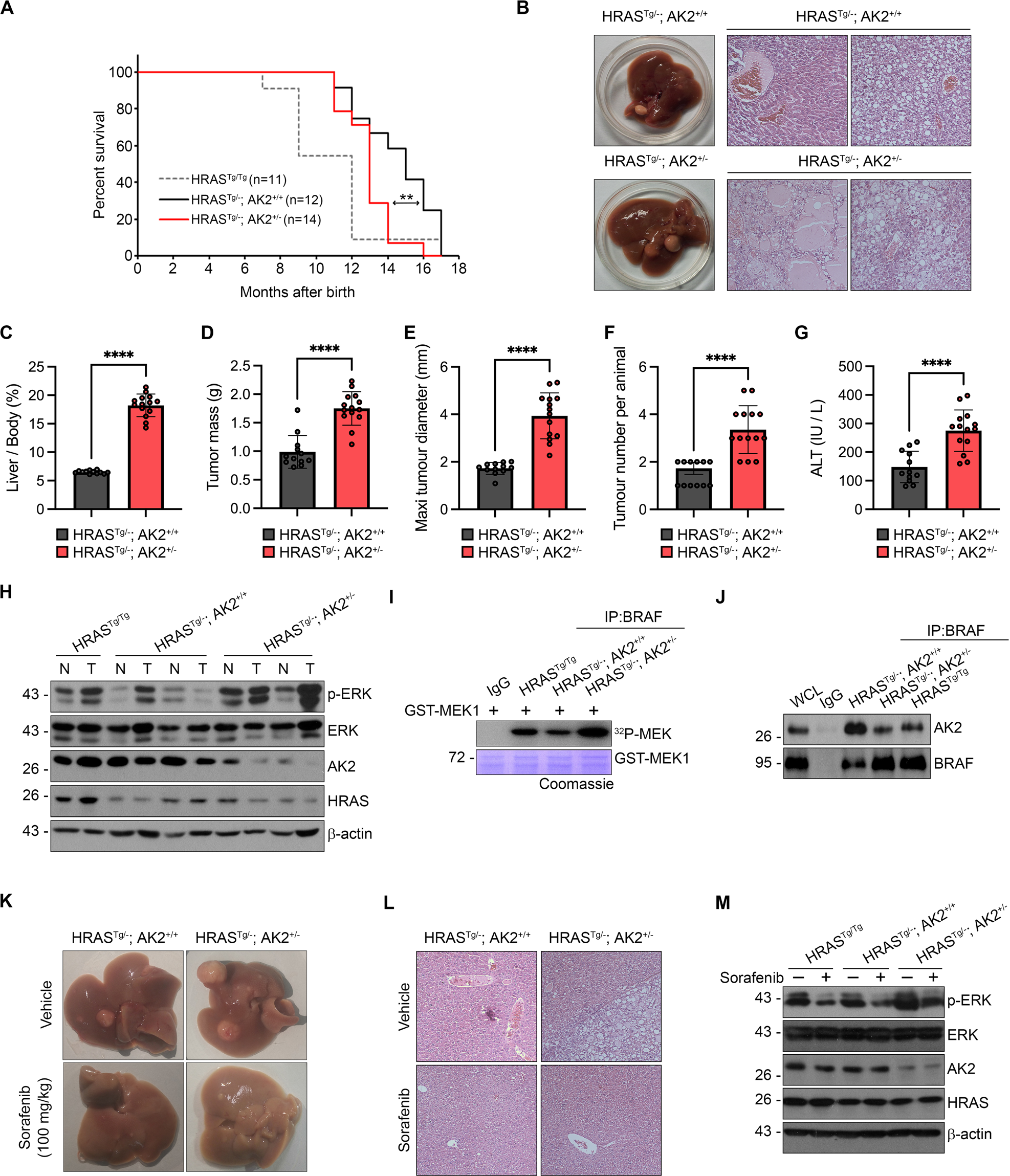 Fig. 5: AK2 ablation exacerbates tumor formation in HRASG12Vmouse model of HCC.