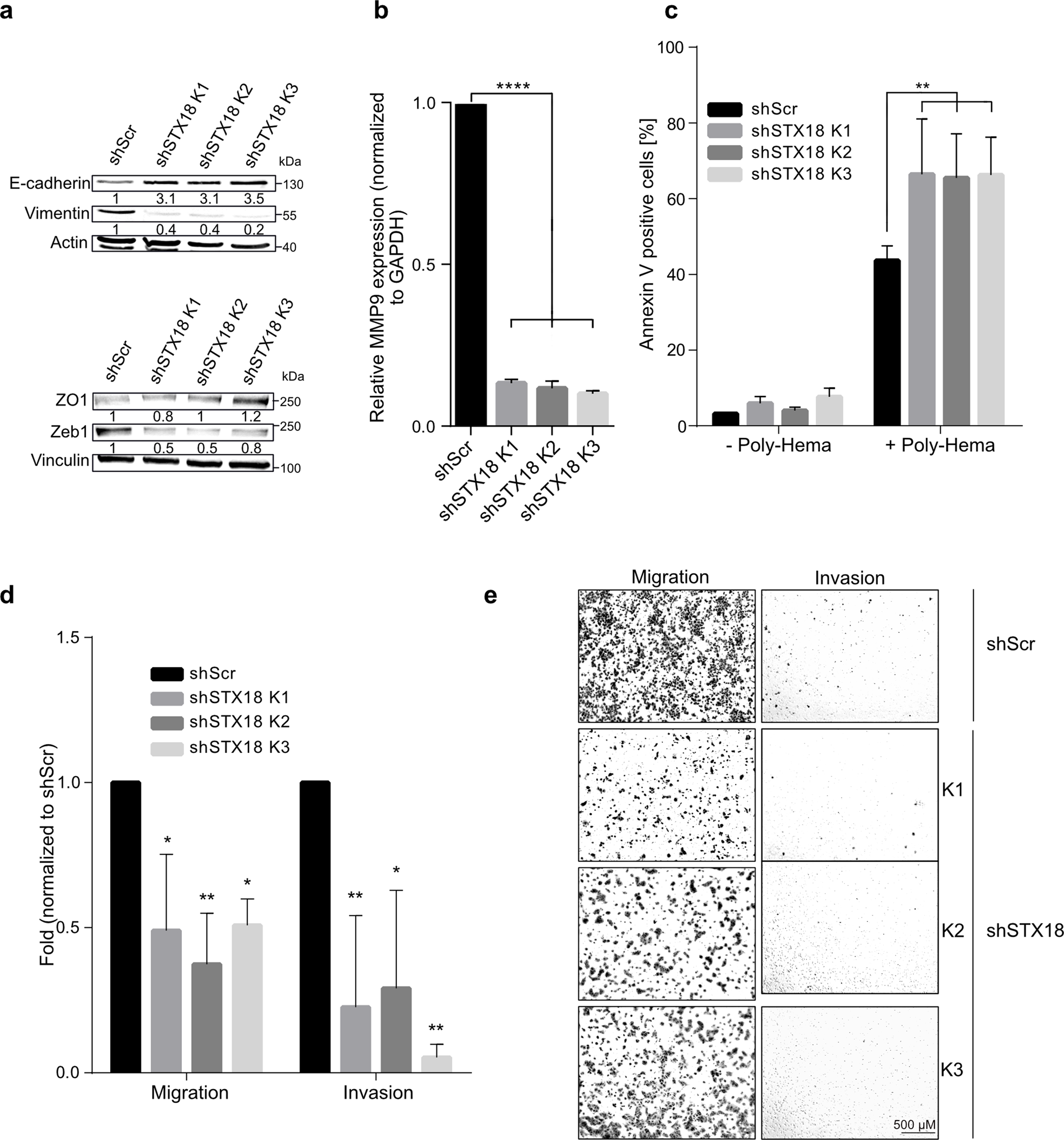 Fig. 5: Syntaxin 18 knockdown leads to an epithelial phenotype and decreased migration and invasion capacities in A549 cells.