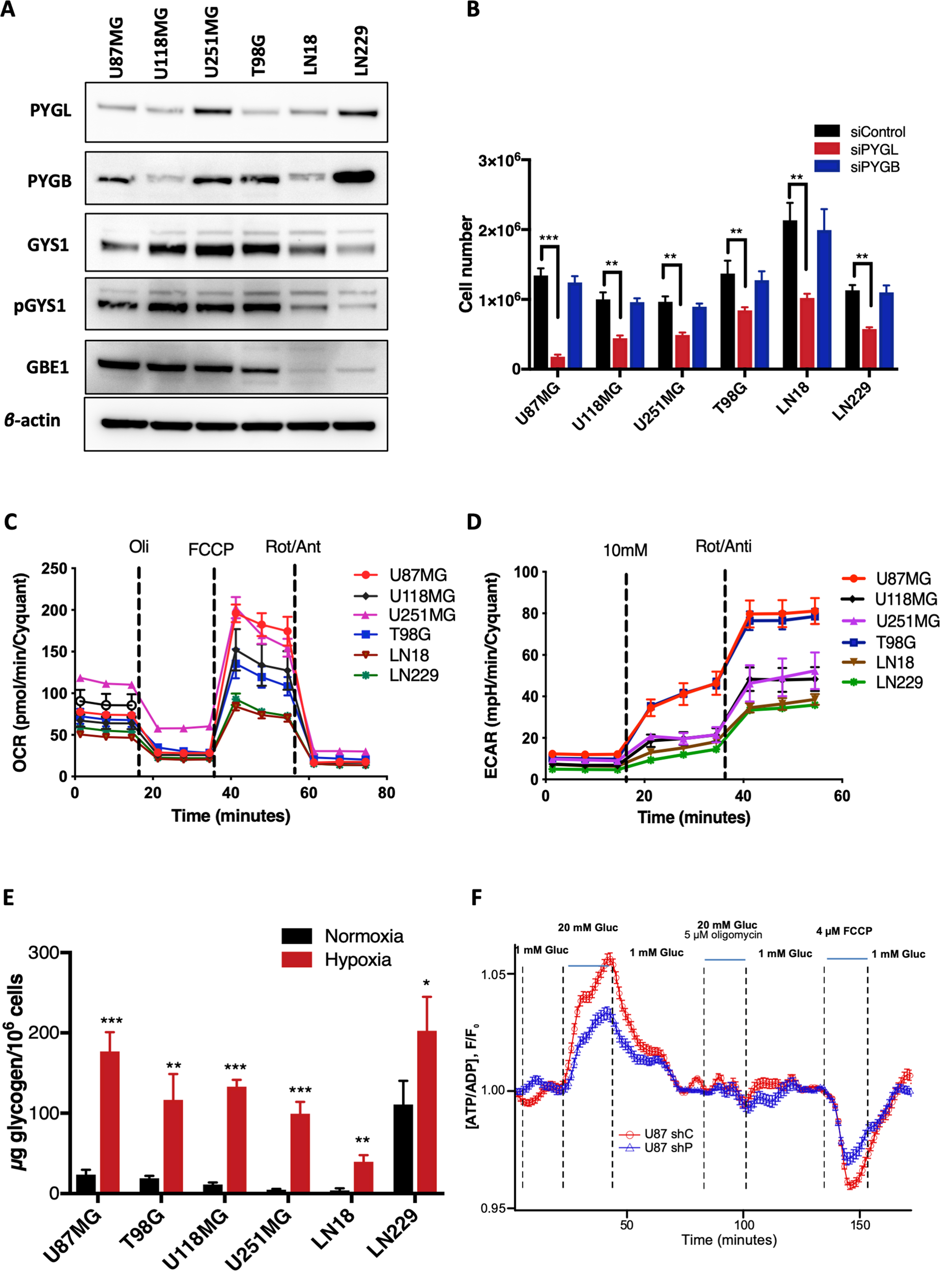 Fig. 1: Characterisation of expression levels of glycogen related enzymes, effect of PYGL knockdown, glycogen accumulation and bioenergetics of six glioblastoma (GBM) cell lines.