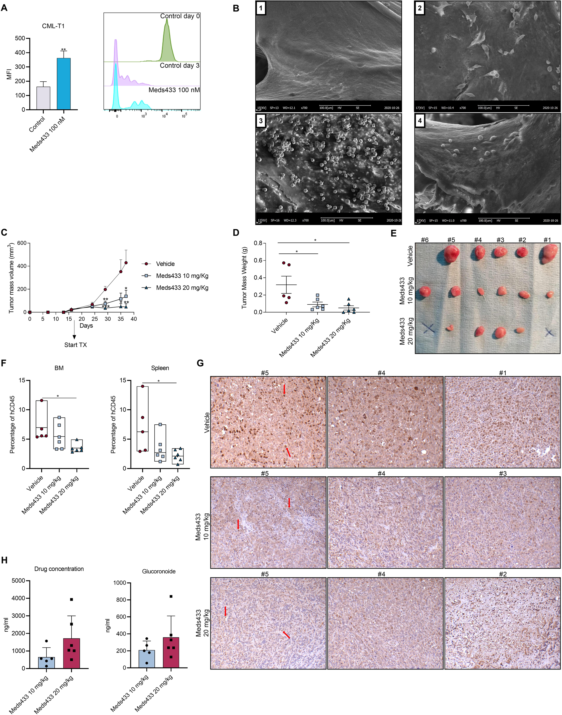 Fig. 3: Meds433 impedes tumor growth in 3D co-culture and xenograft mice.