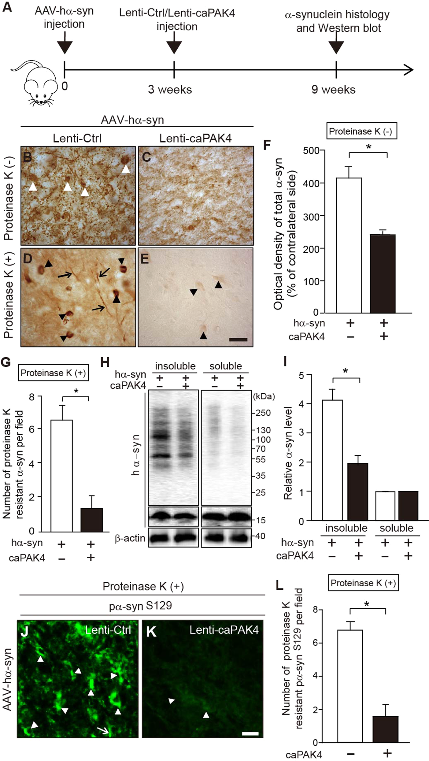 Fig. 4: caPAK4 reduces α-synuclein aggregates in the AAV-hα-syn-induced PD model.