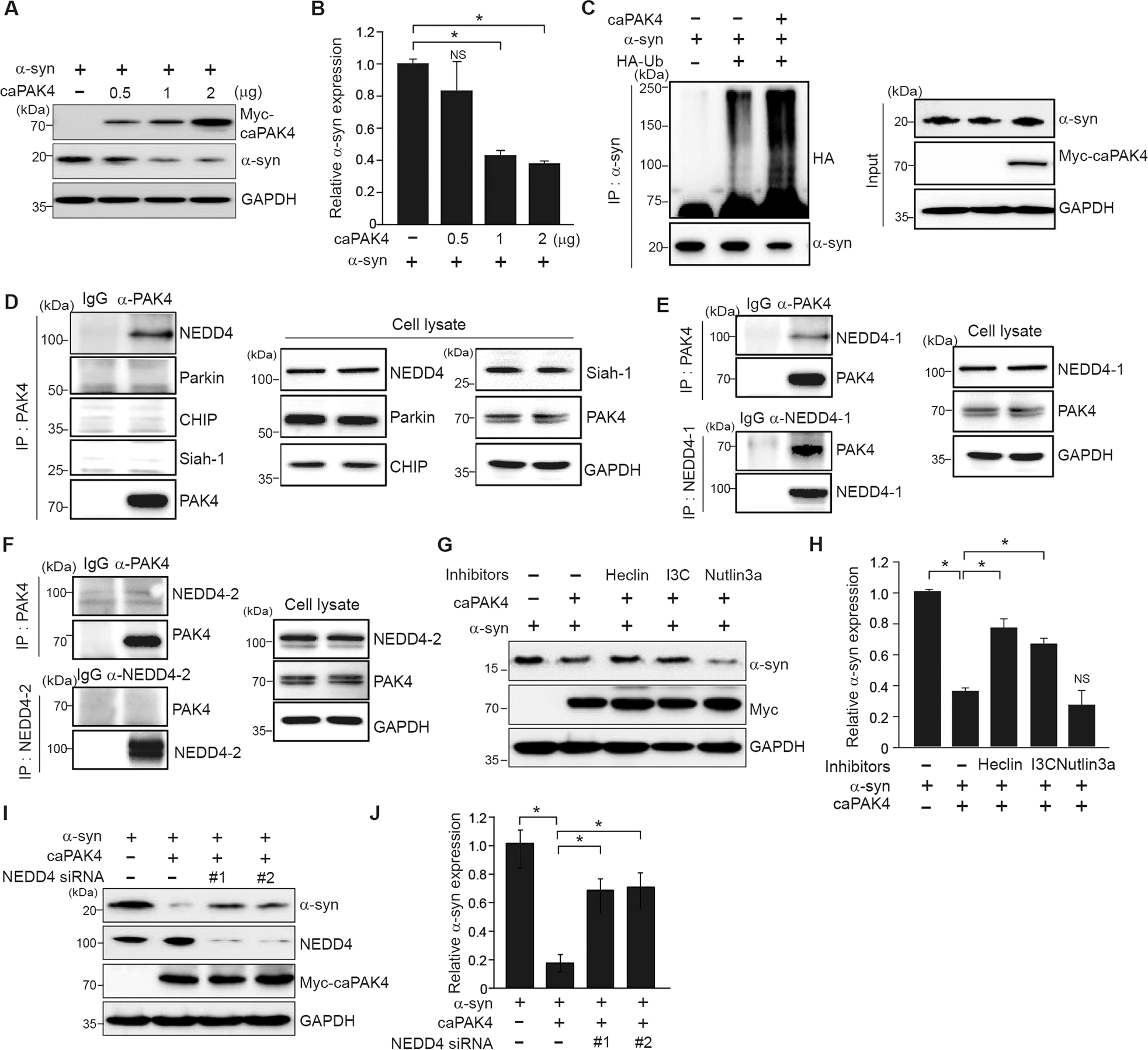 Fig. 6: NEDD4-1 is required for caPAK4-induced α-synuclein degradation in SHSY-5Y cells.