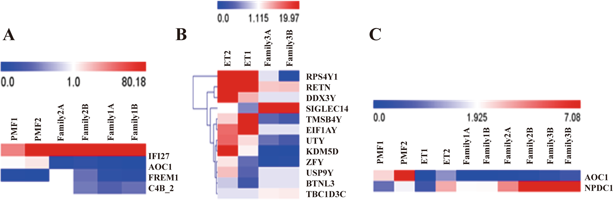 Fig. 2: Familial PMF with CHST15 mutation exhibits activation of immune/inflammation/extracellular matrix signals in PBMNCs.