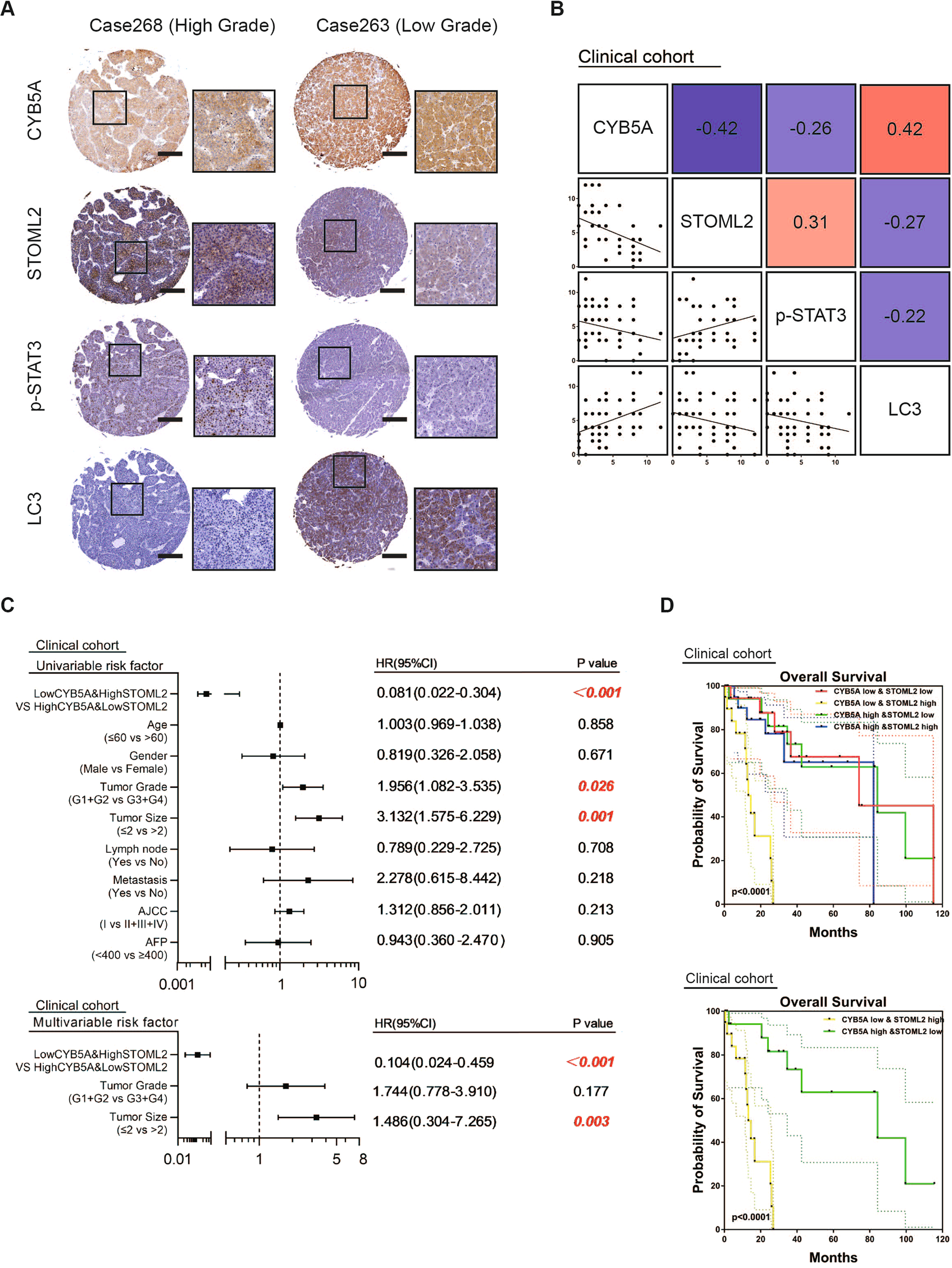 Fig. 6: Low CYB5A and high STOML2 suggest a poor prognosis.