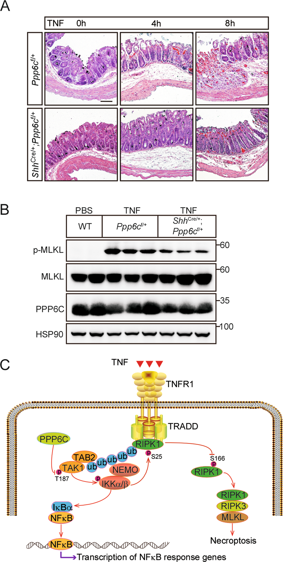 Fig. 6: PPP6C loss alleviates TNF-induced necroptosis in SIRS model.