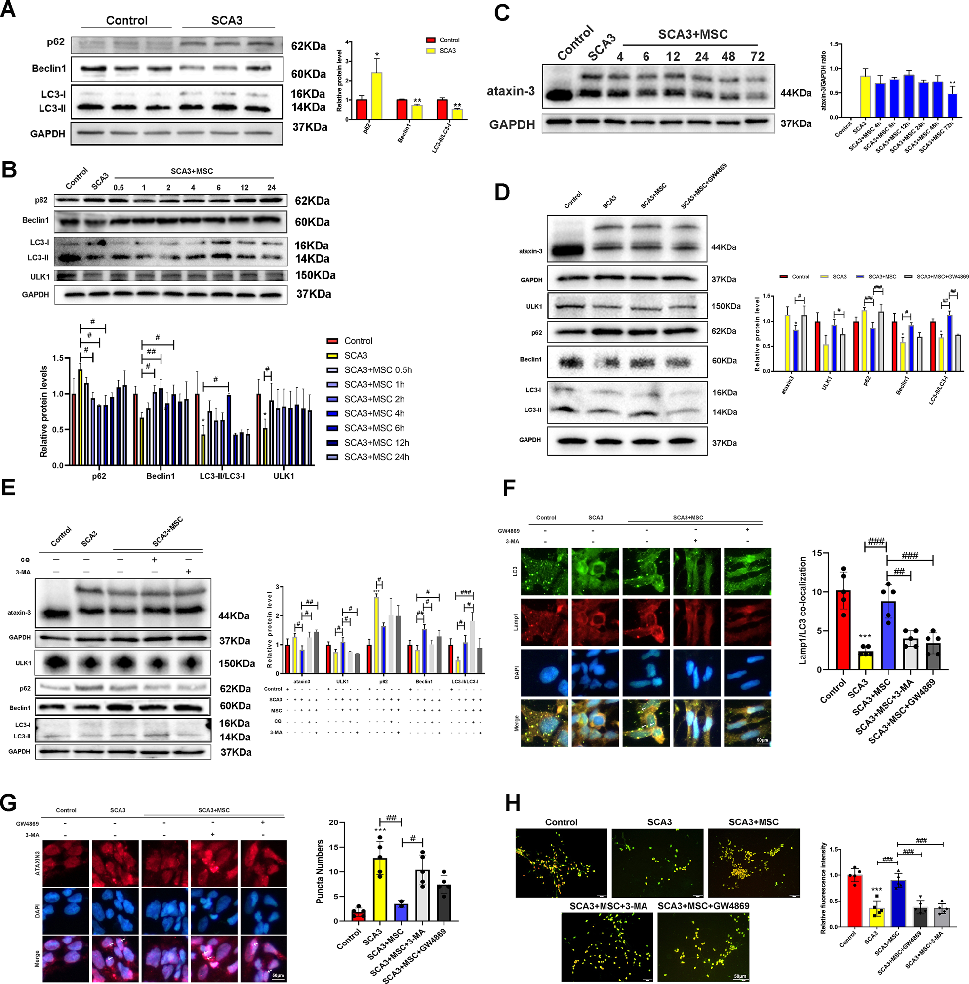 Fig. 2: MSCs reduce intracellular mutant protein ataxin-3 levels in SCA3 patients.