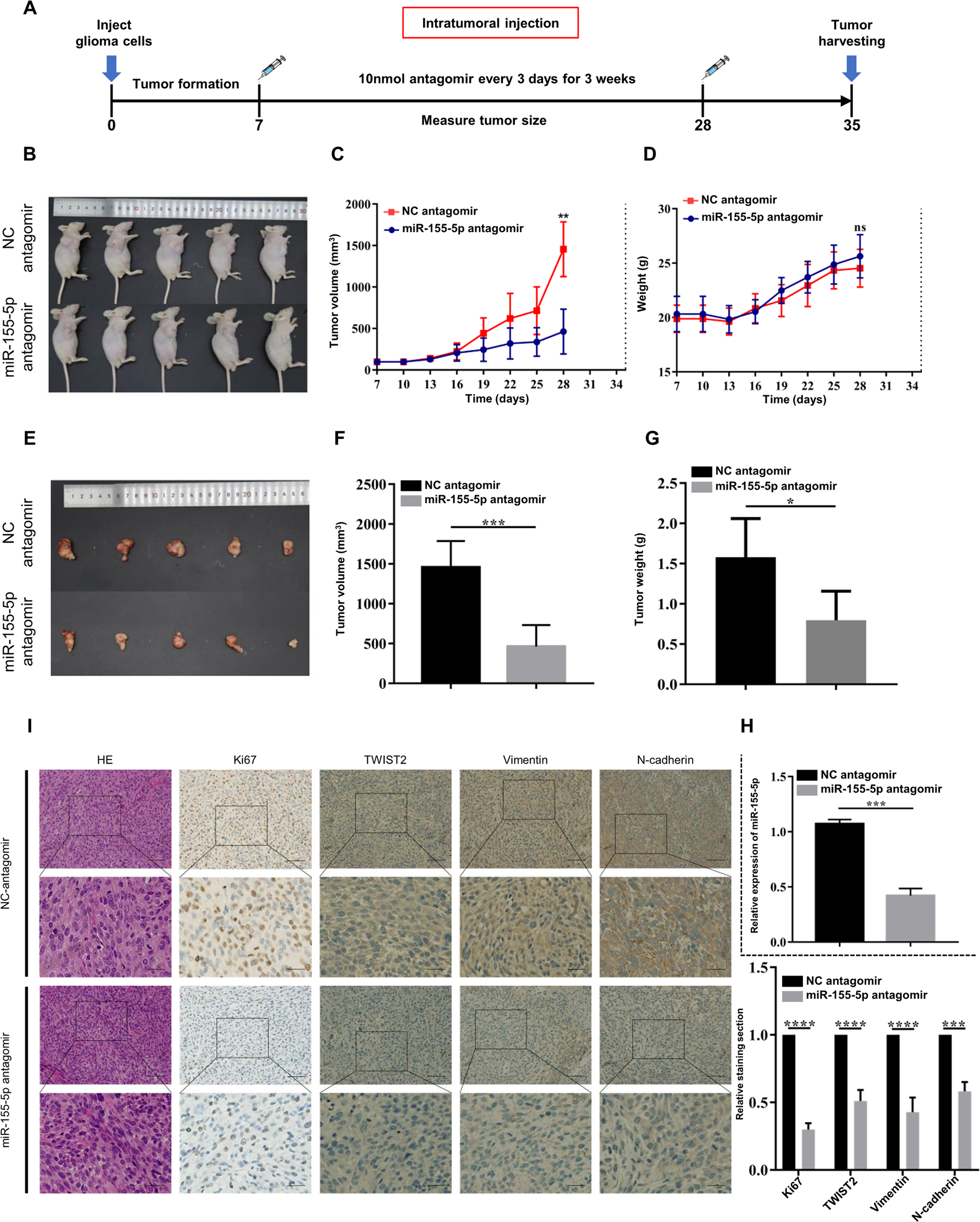 Fig. 4: Specific inhibition of miR-155-5p can suppress glioma progression in vivo.