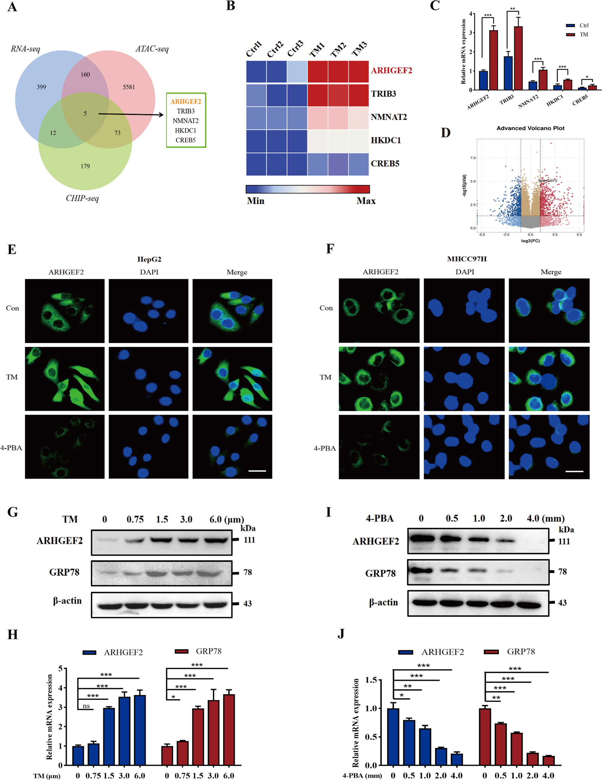 ARHGEF2/EDN1 pathway participates in ER stress-related drug resistance of  hepatocellular carcinoma by promoting angiogenesis and malignant  proliferation | Cell Death & Disease