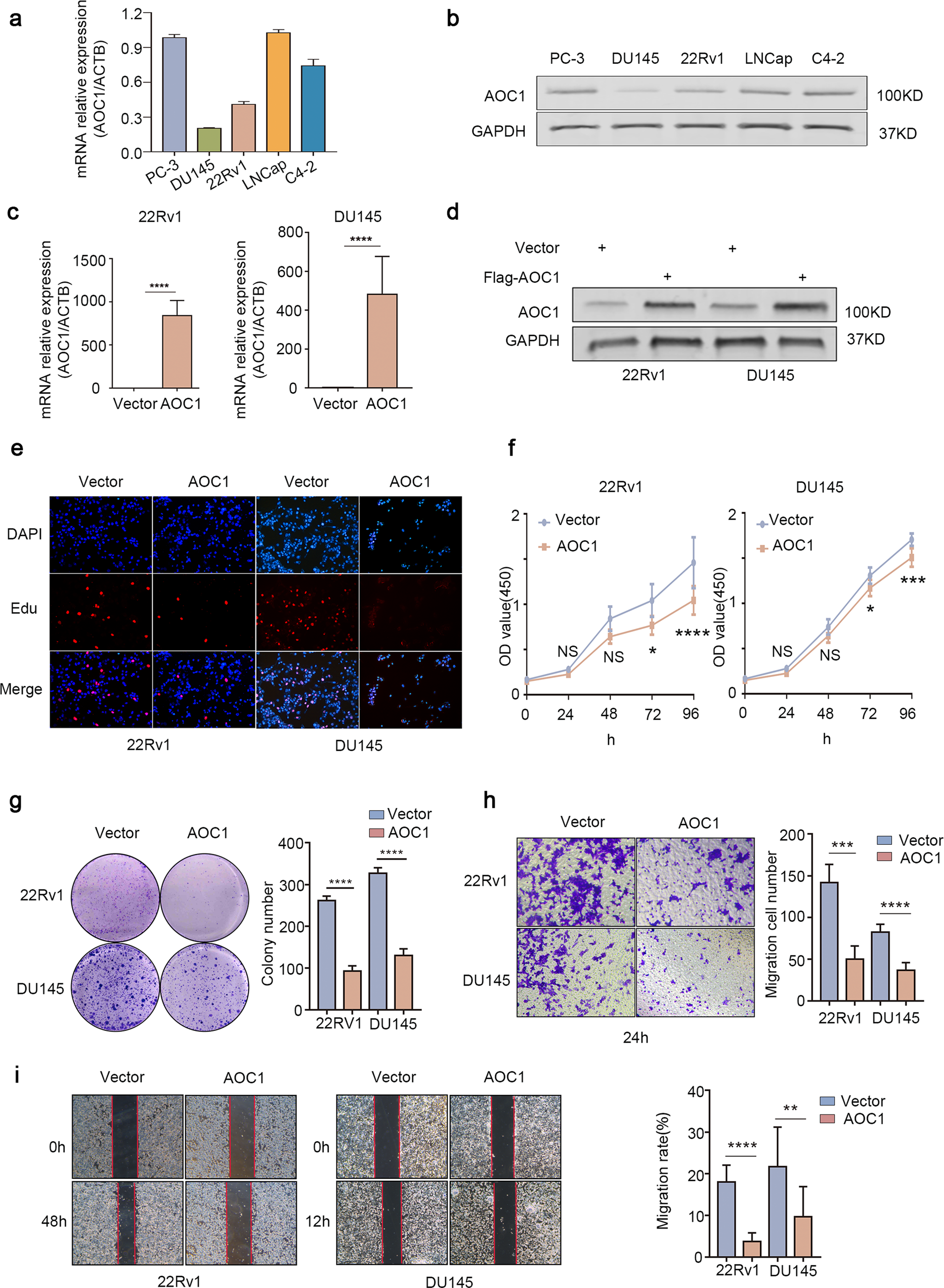 Fig. 3: AOC1 accretion depletes the malignant potentials of prostate cancer cells.