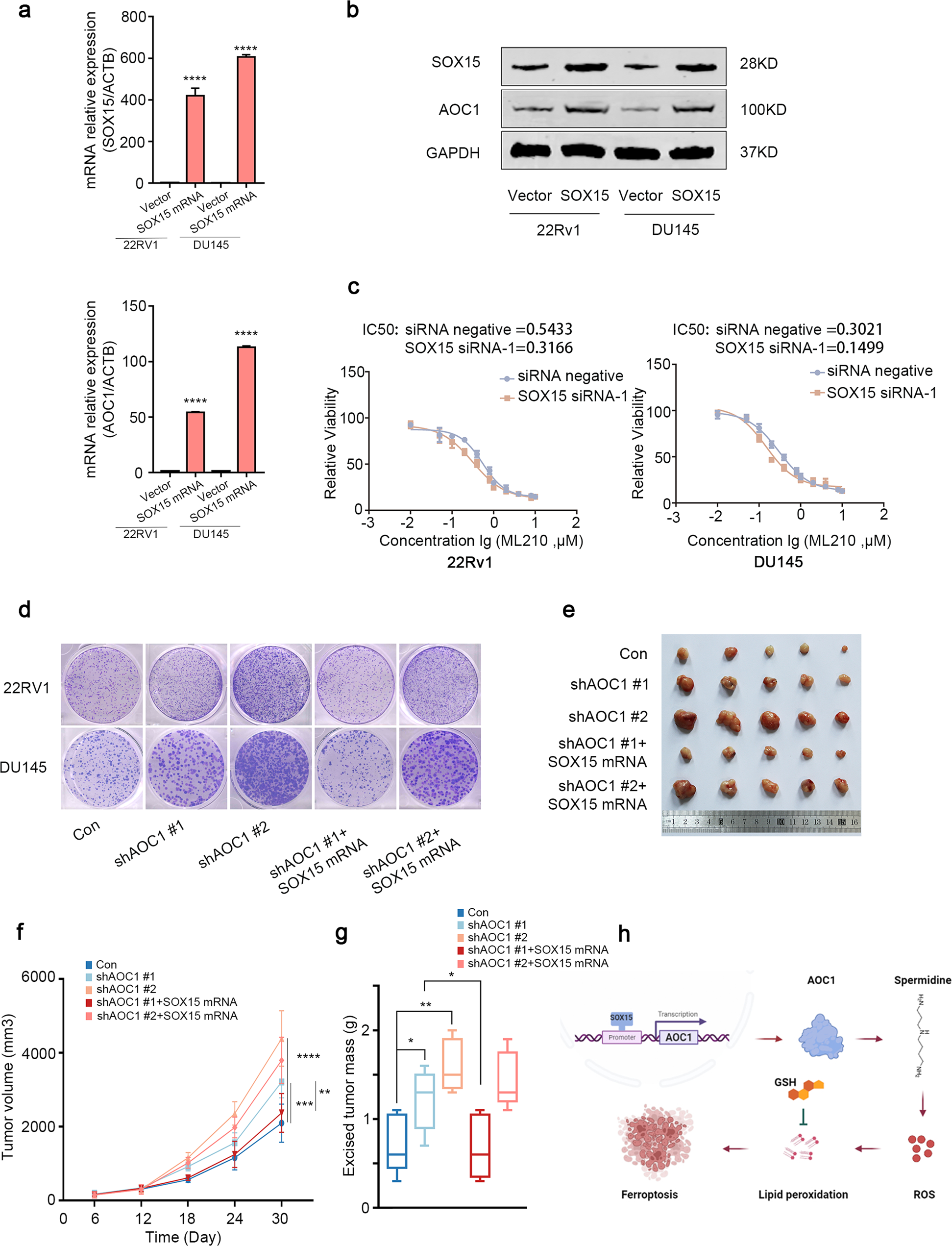 Fig. 7: SOX15 affects the progression of prostate cancer by regulating the expression of AOC1.