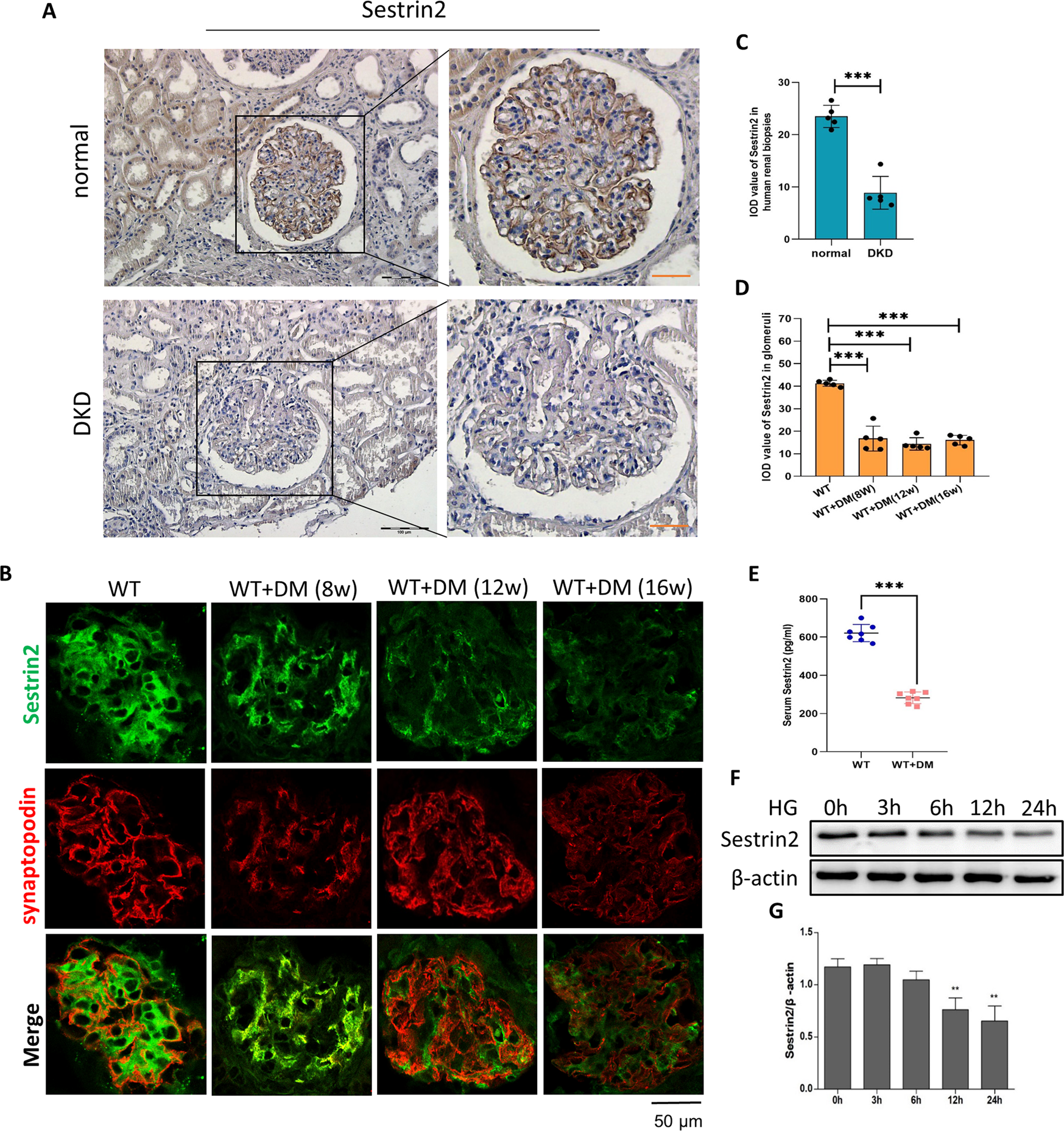 Sestrin2 remedies podocyte injury via orchestrating TSP-1/TGF-β1/Smad3 axis  in diabetic kidney disease | Cell Death & Disease