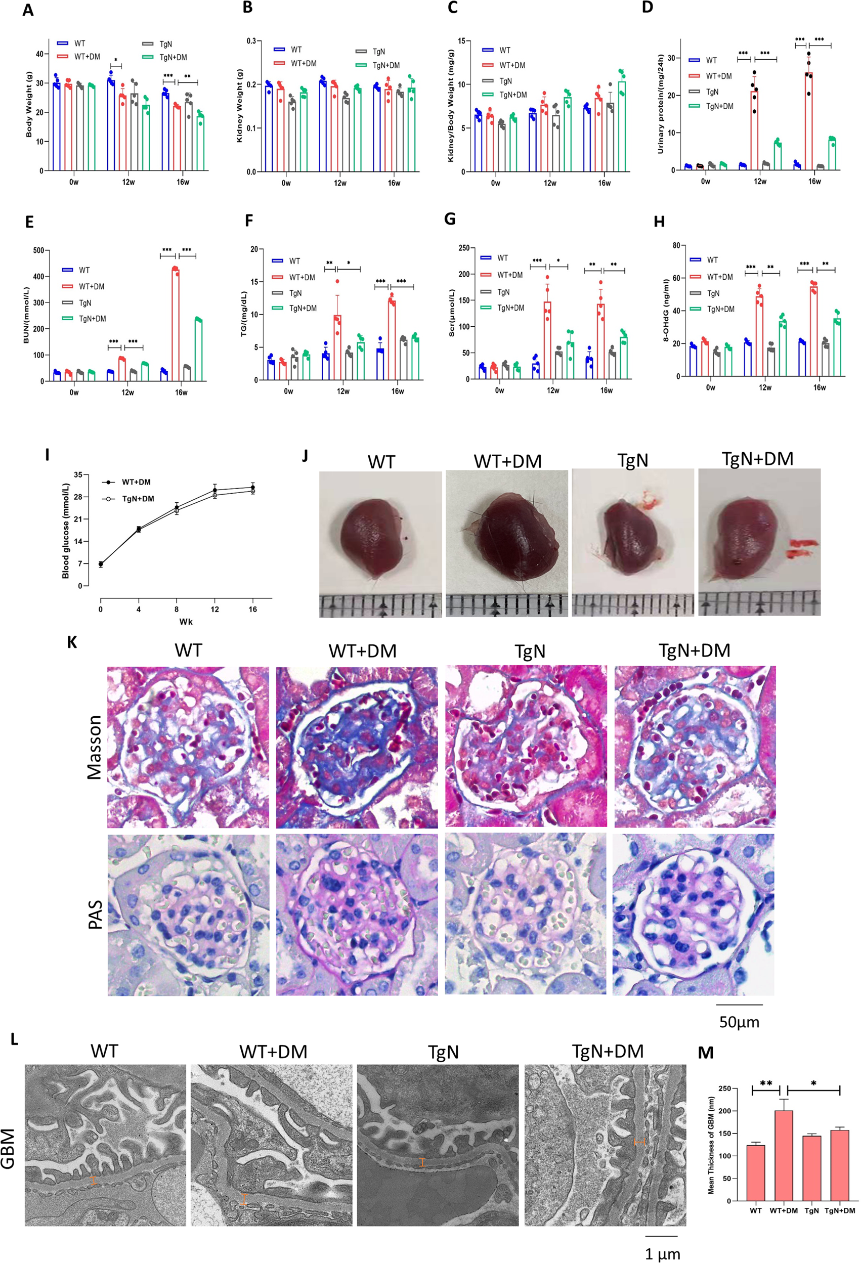 Fig. 5: Sestrin2 prevents glomerular manifestations in STZ-induced diabetic mice.
